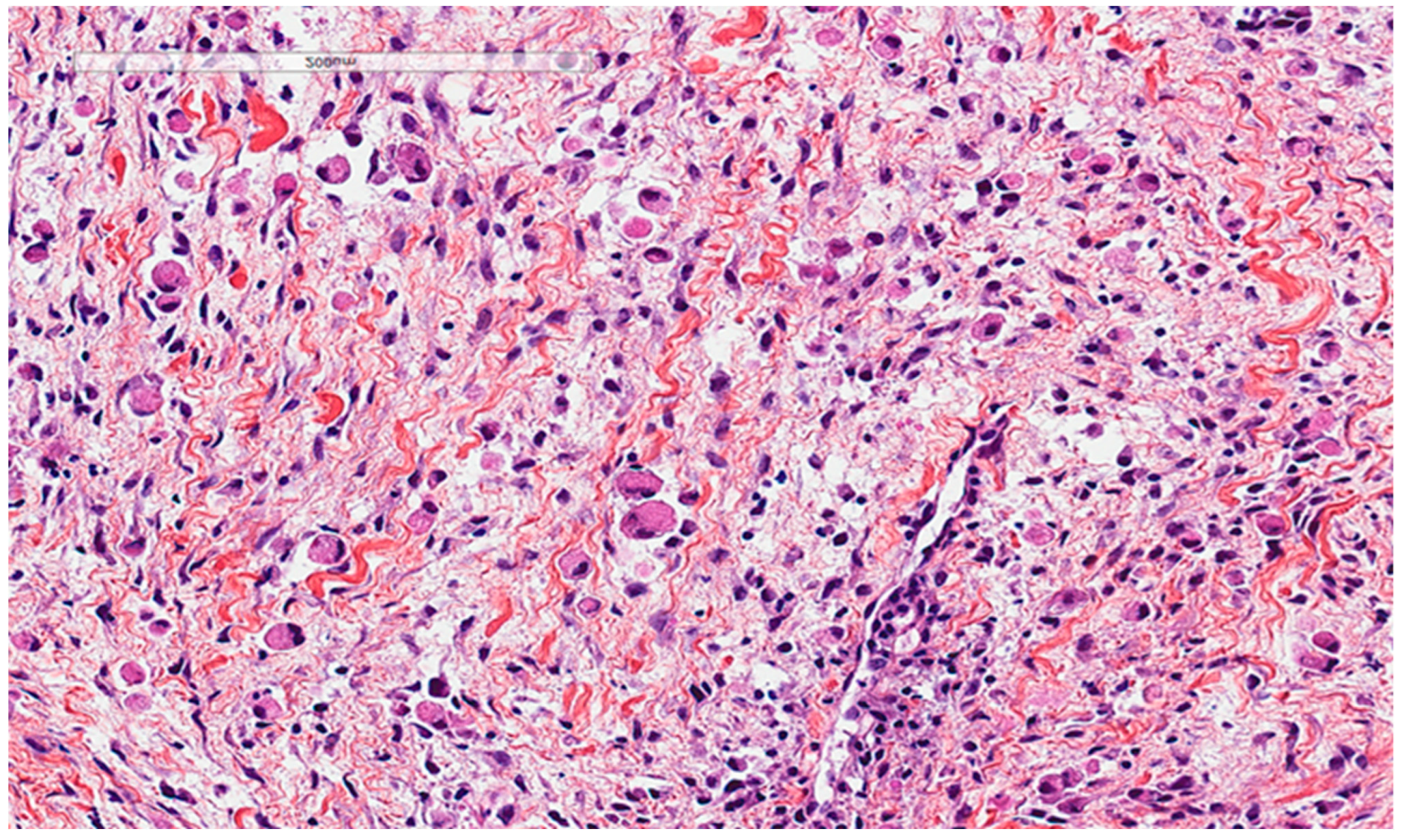 Diagnostics 13 00271 g004 Diagnostics 13 00271 g004