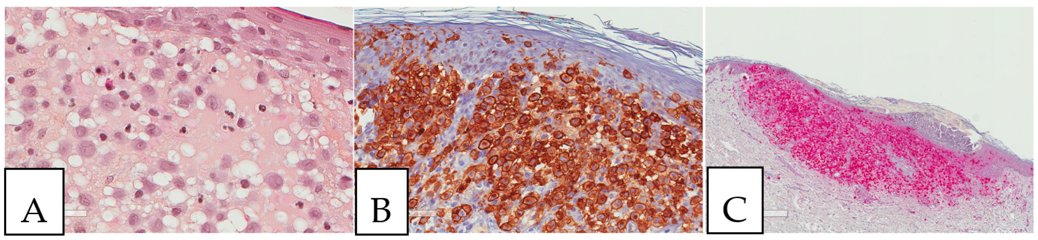 Diagnostics 13 00271 g005 Diagnostics 13 00271 g005