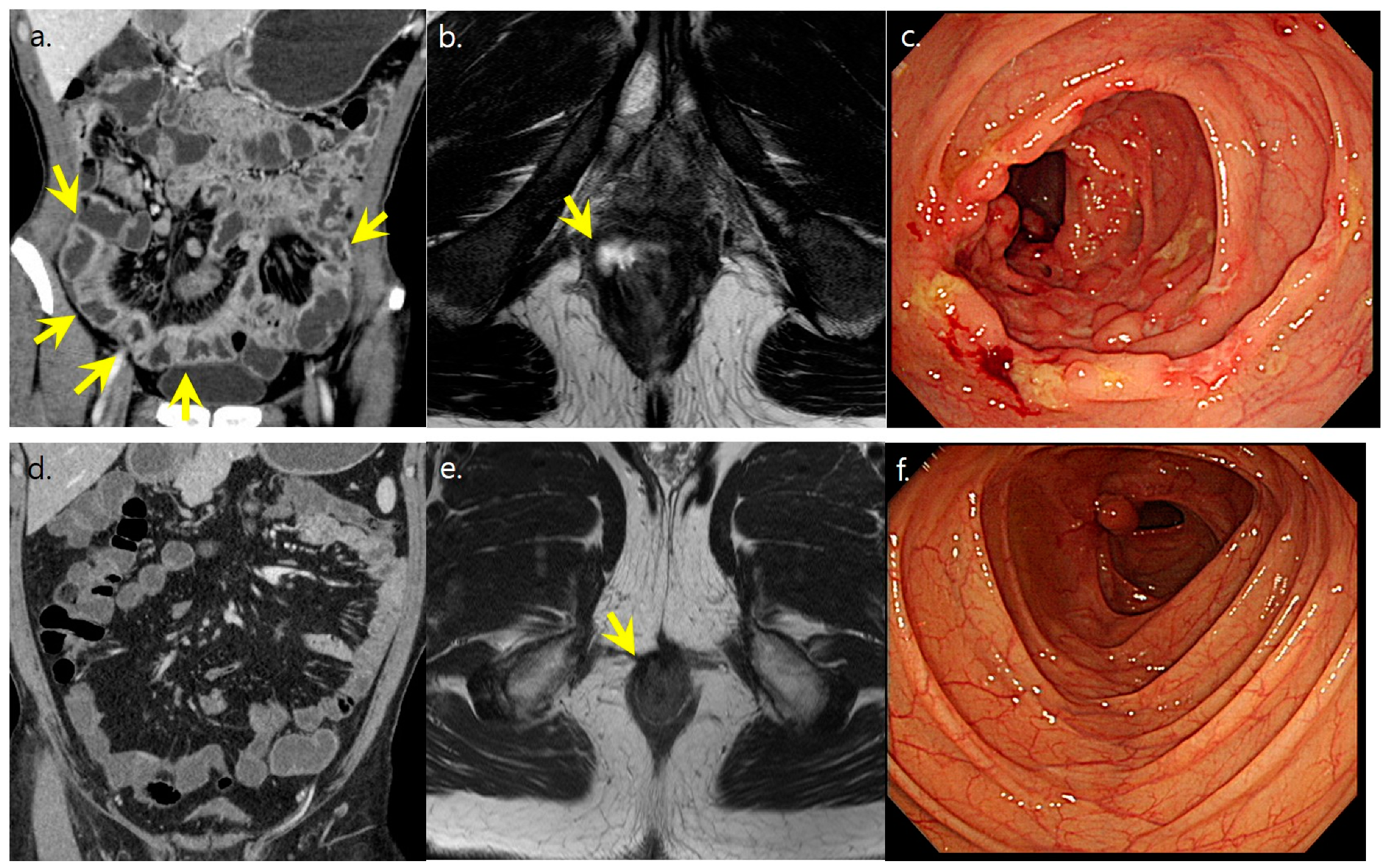 Diagnostics 13 00273 g004