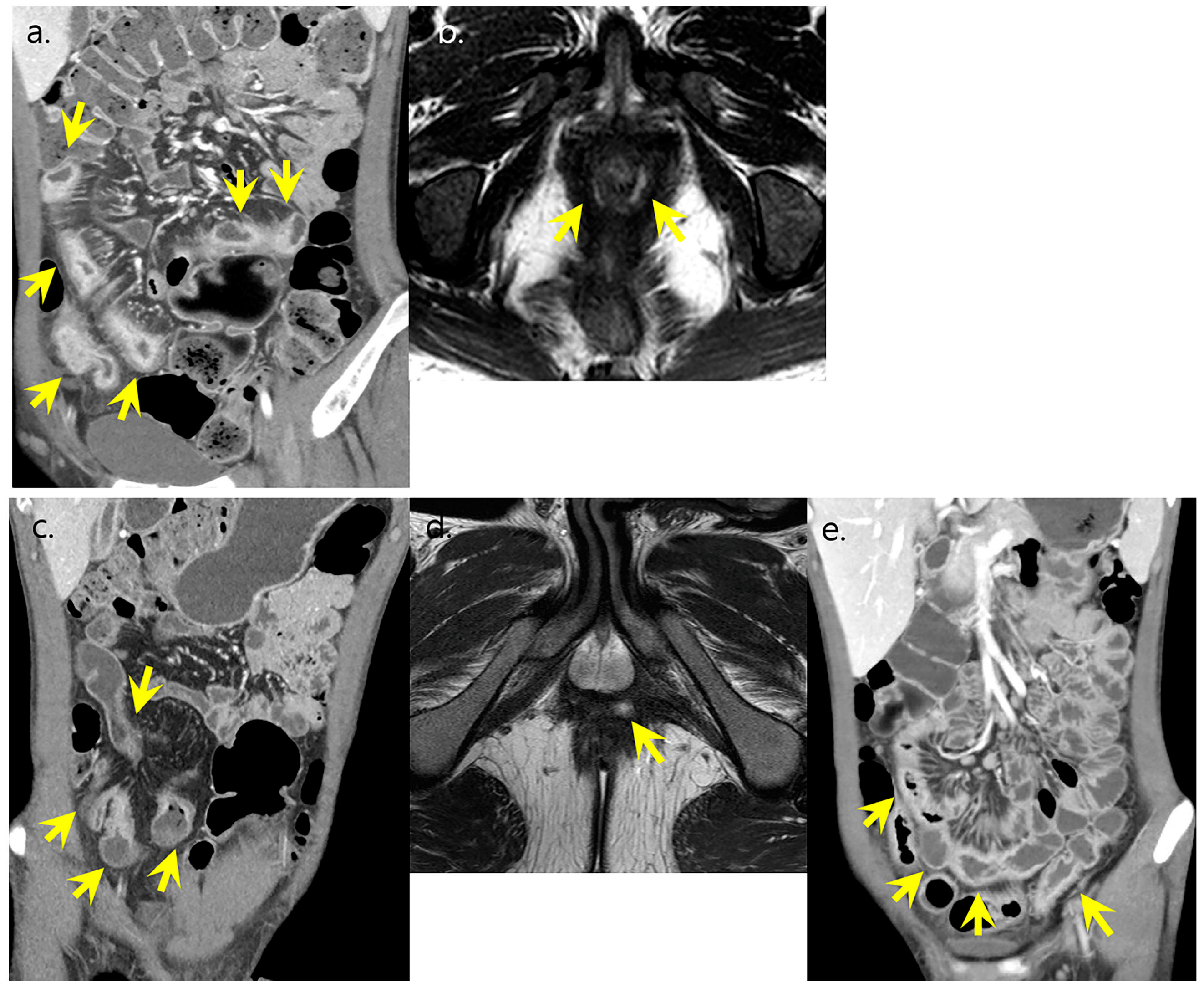 Diagnostics 13 00273 g005