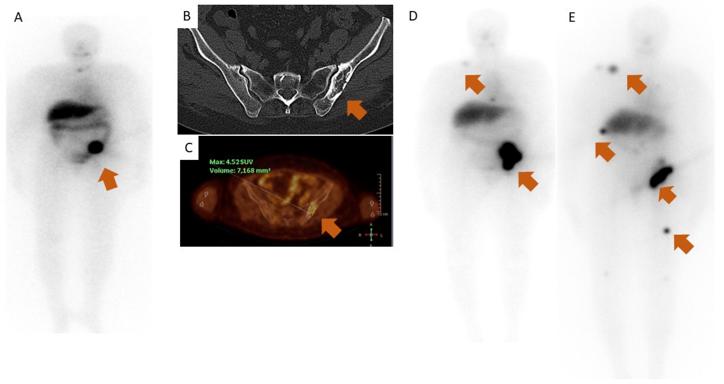 Diagnostics 13 00281 g001