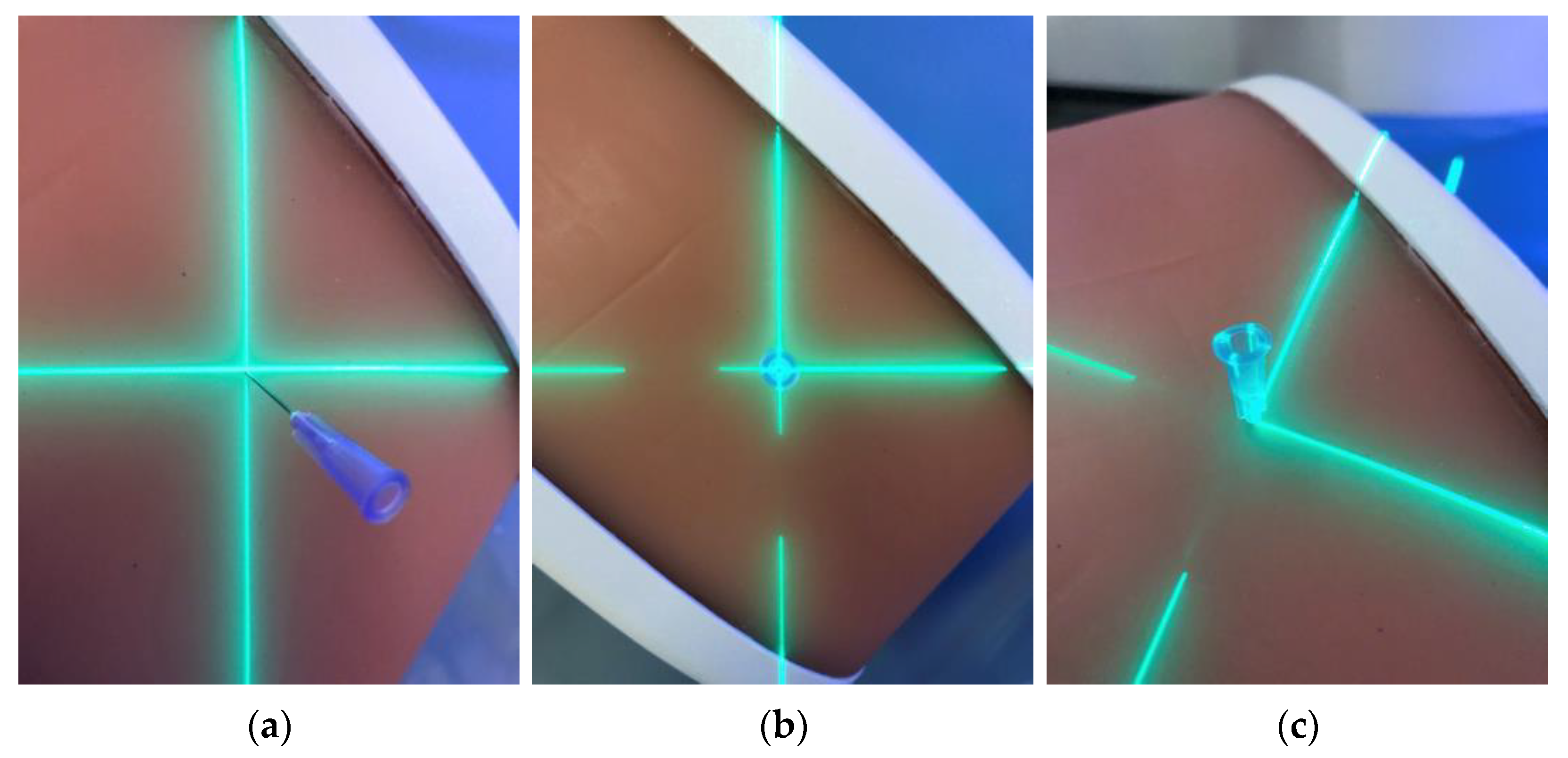 Diagnostics 13 00282 g004