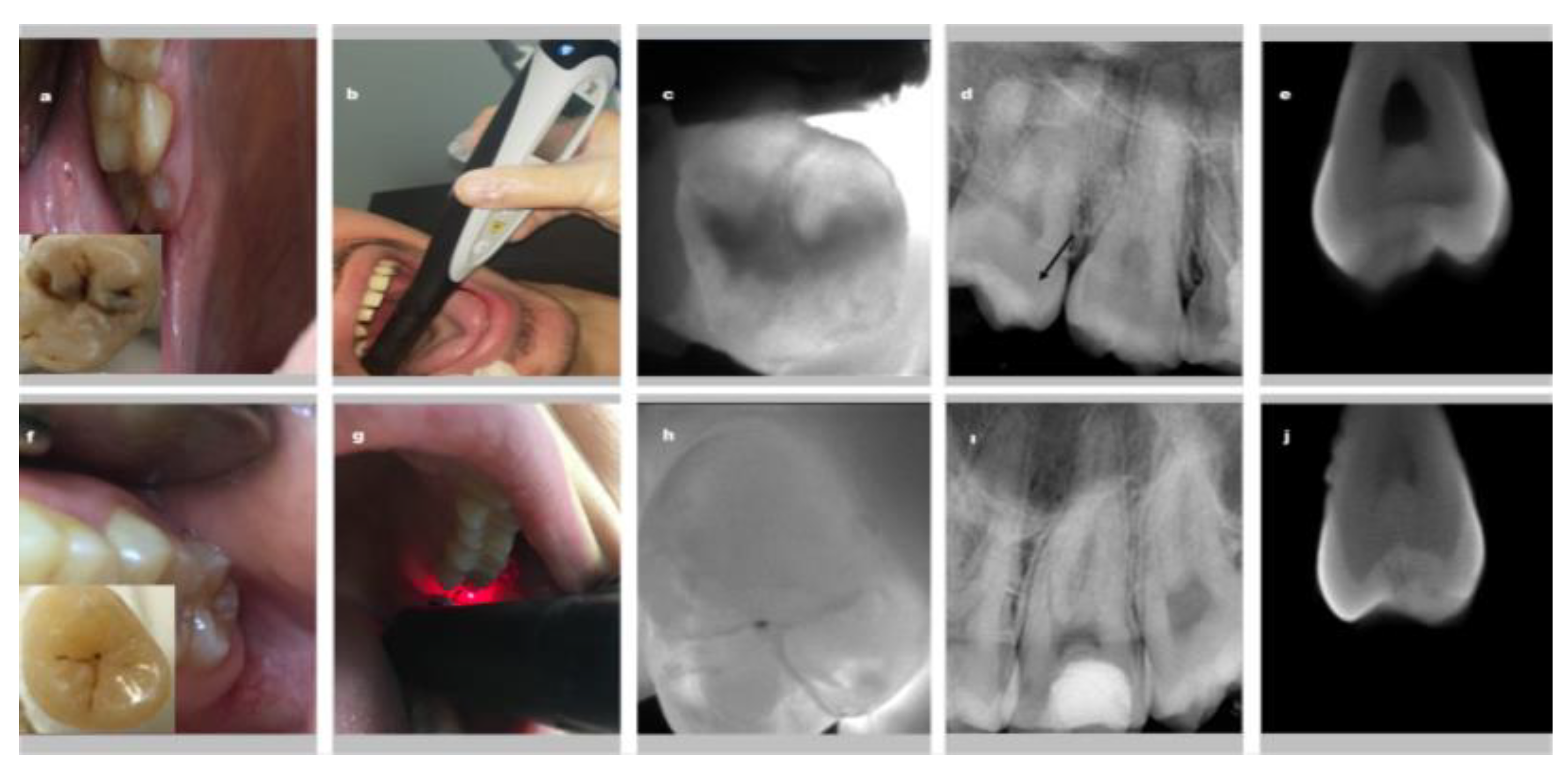 Diagnostics 13 00284 g002 Diagnostics 13 00284 g002