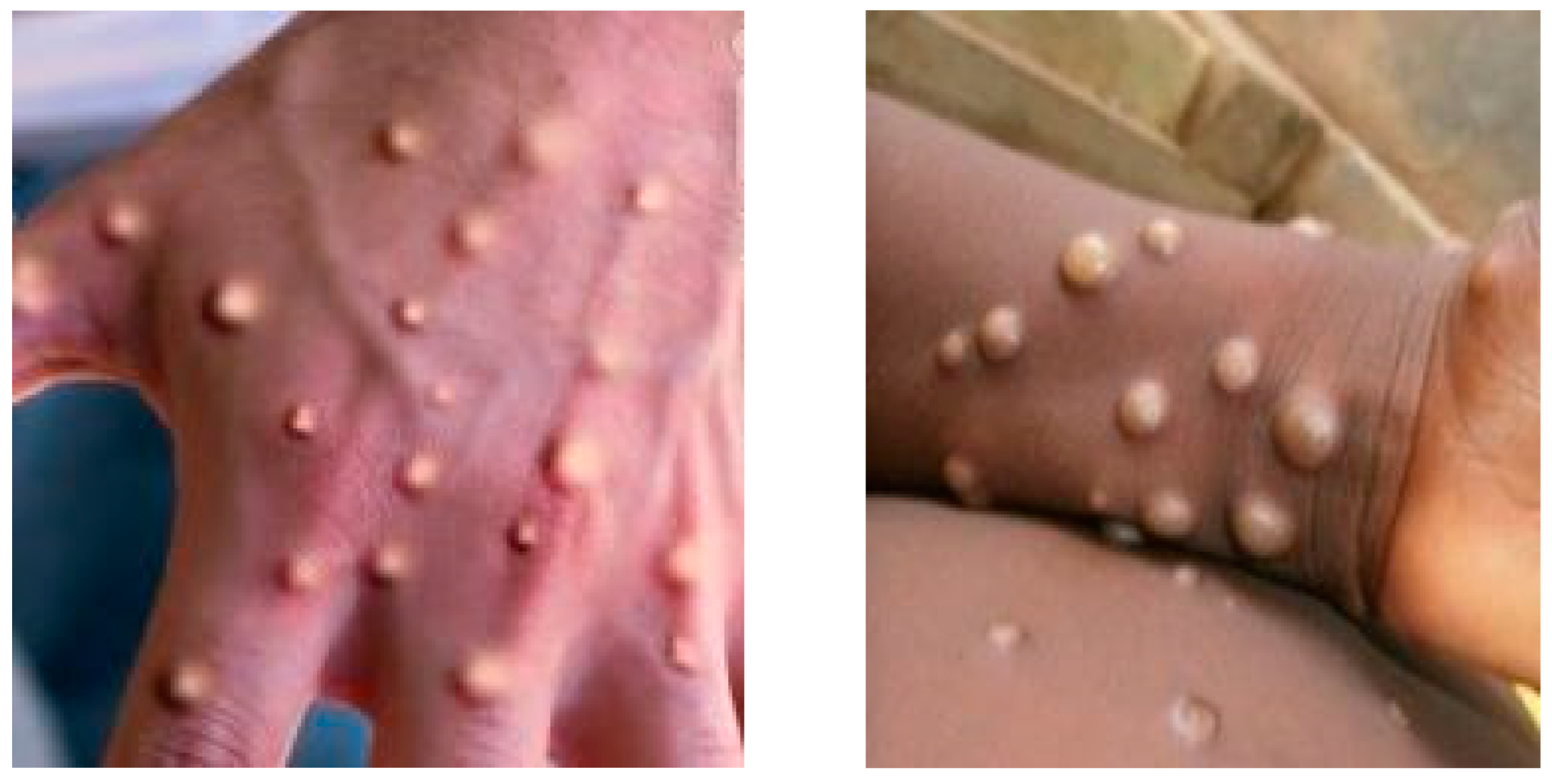 Diagnostics 13 00292 g001