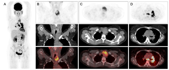 Diagnostics 13 00296 g001