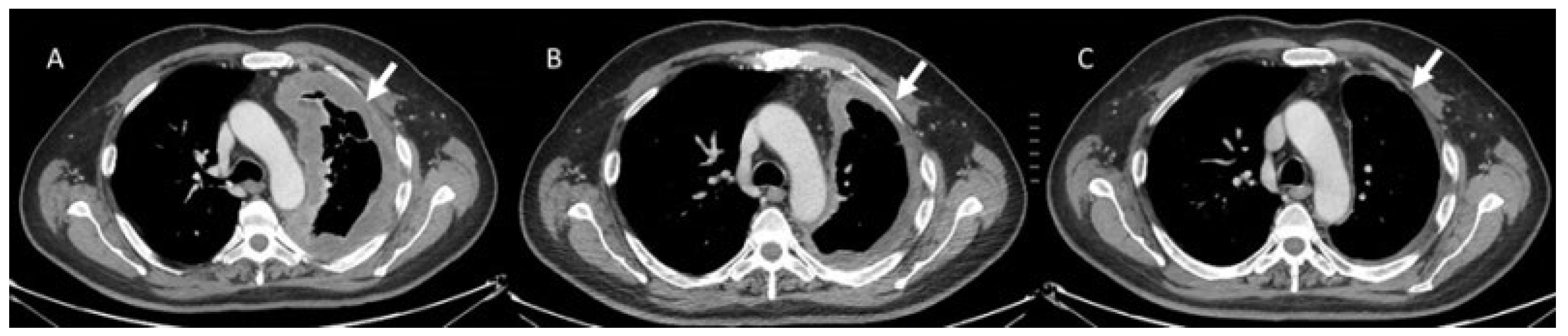 Diagnostics 13 00302 g001