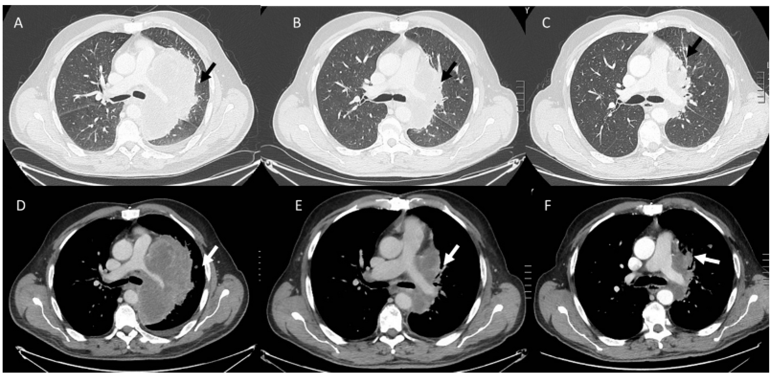 Diagnostics 13 00302 g002