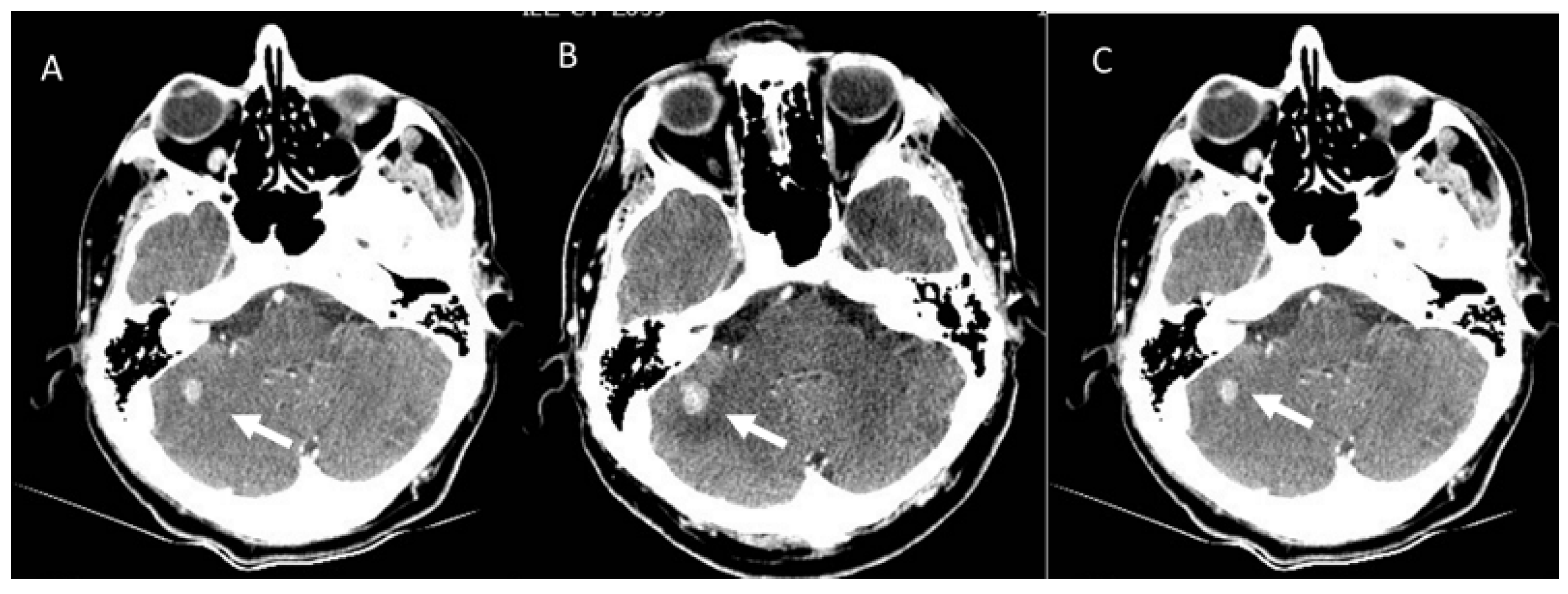 Diagnostics 13 00302 g003