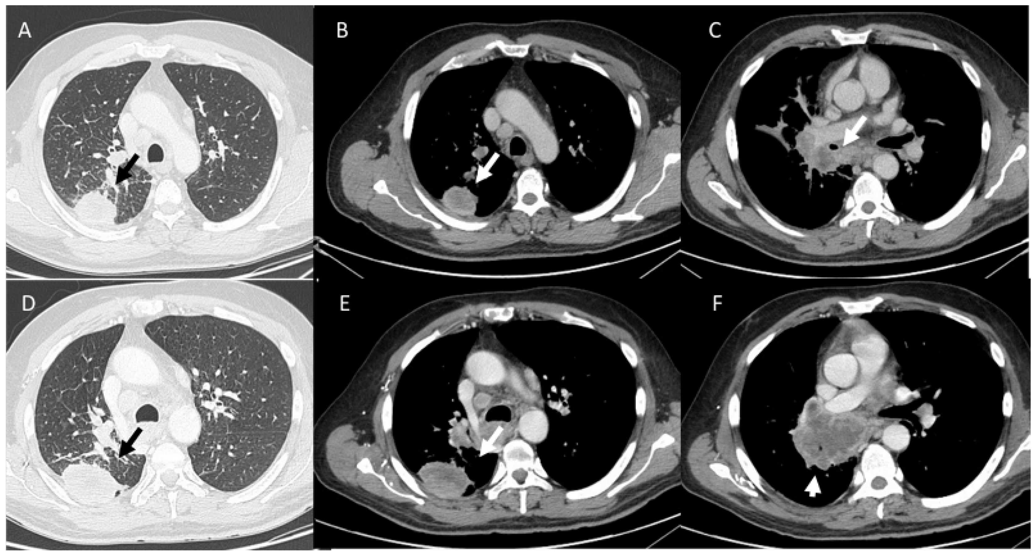 Diagnostics 13 00302 g004