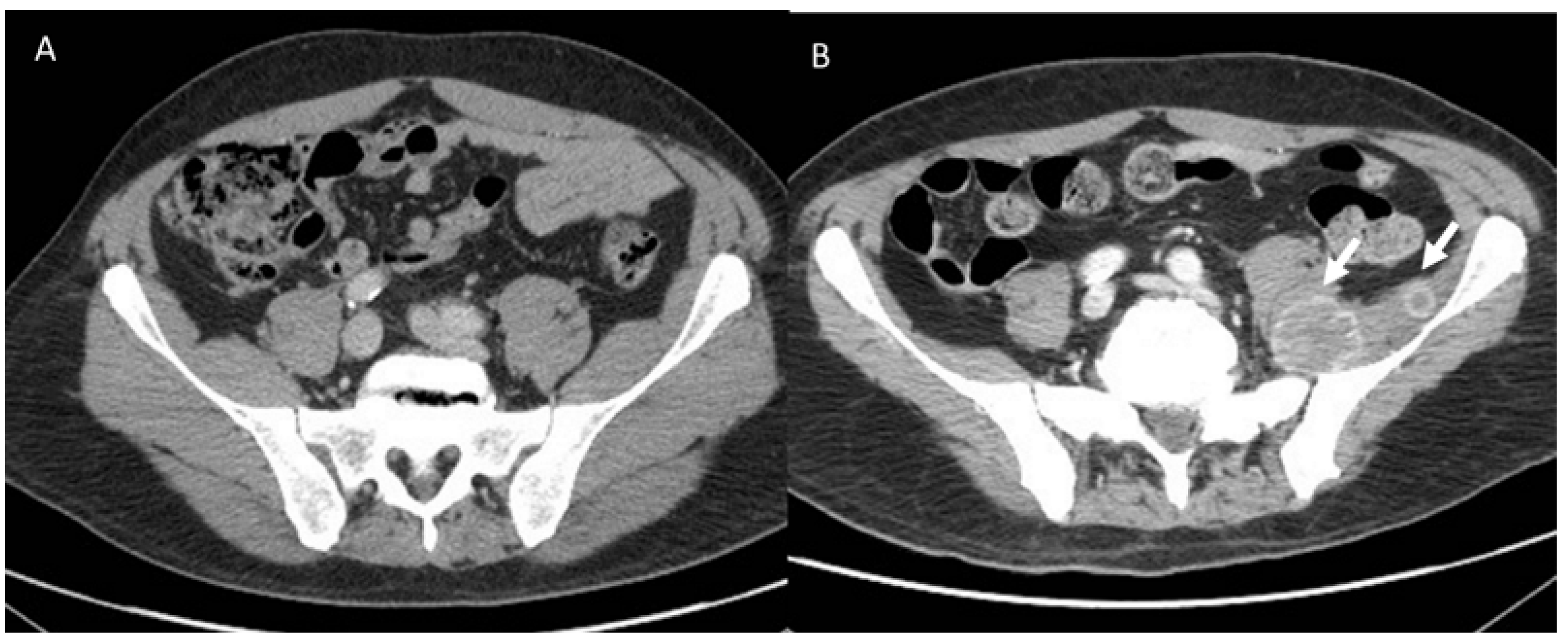 Diagnostics 13 00302 g005