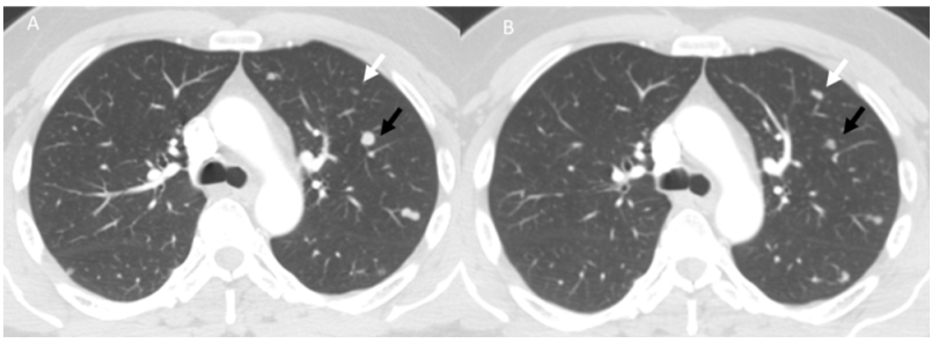 Diagnostics 13 00302 g006
