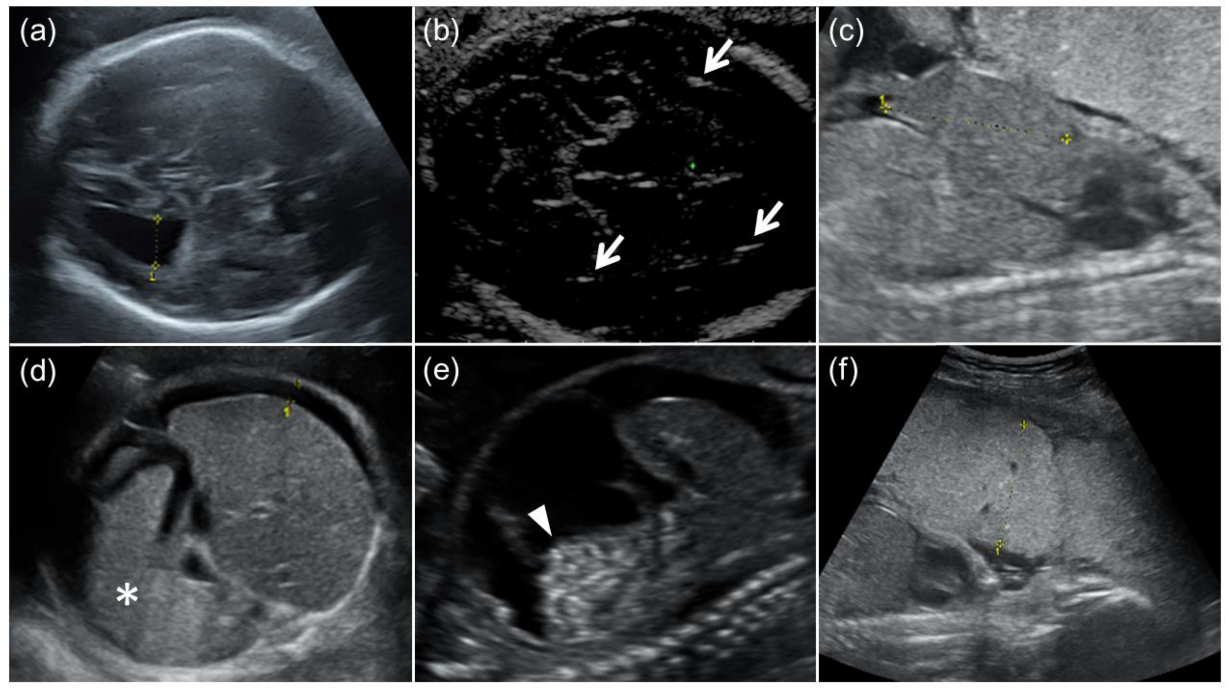 Diagnostics 13 00306 g001