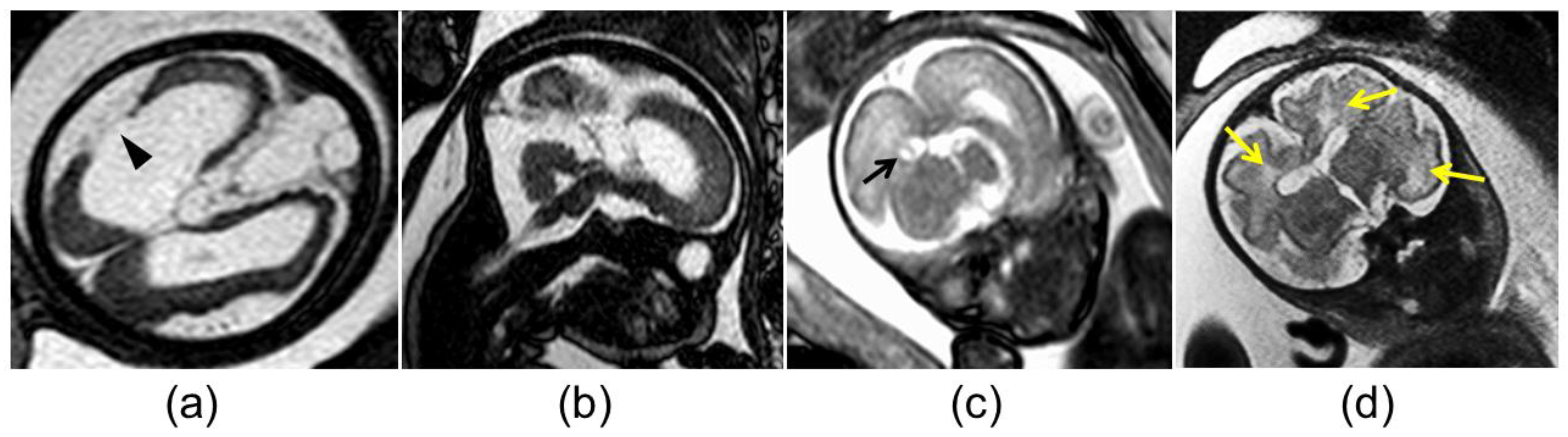 Diagnostics 13 00306 g002