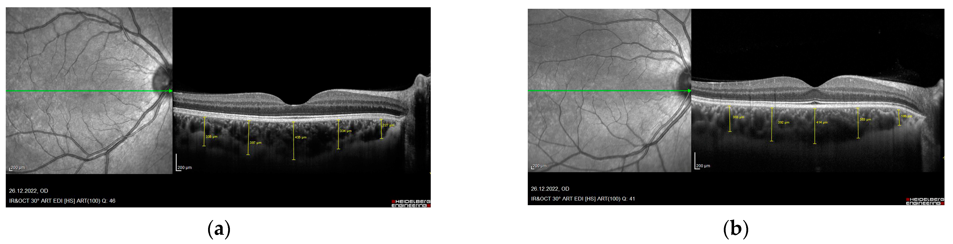 Diagnostics 13 00314 g001