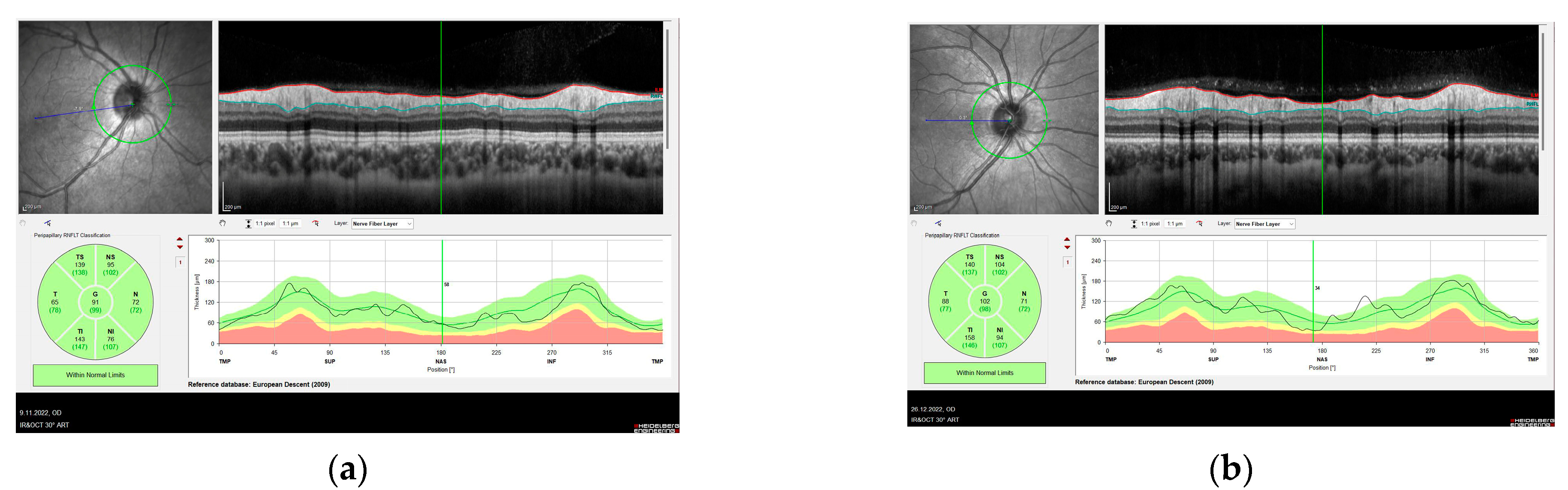 Diagnostics 13 00314 g002