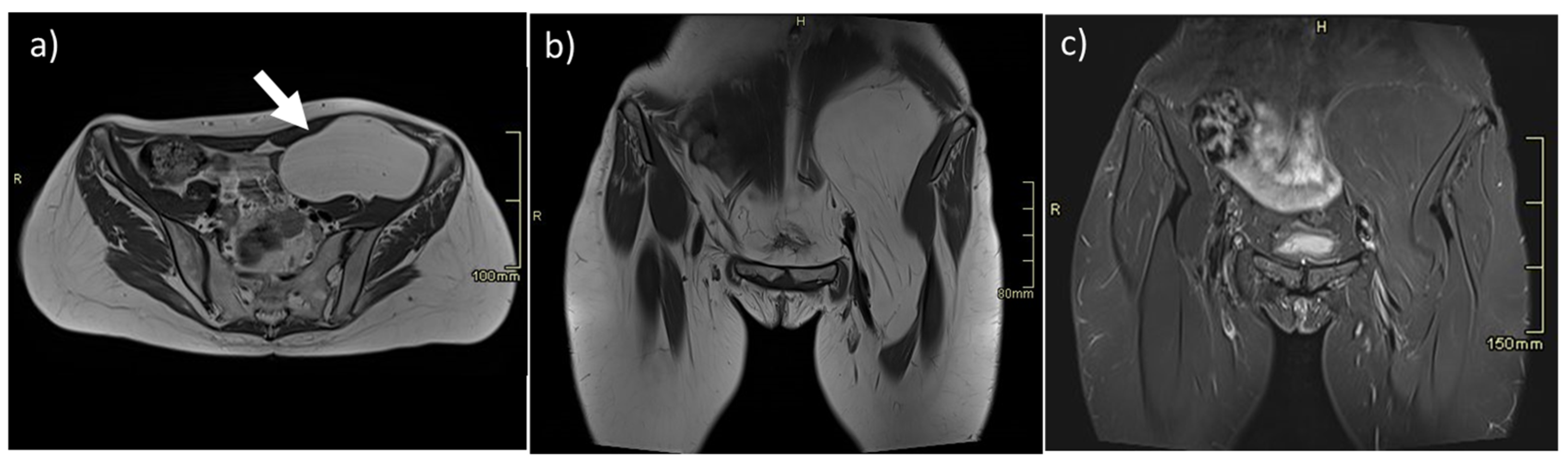 Diagnostics 13 00315 g001