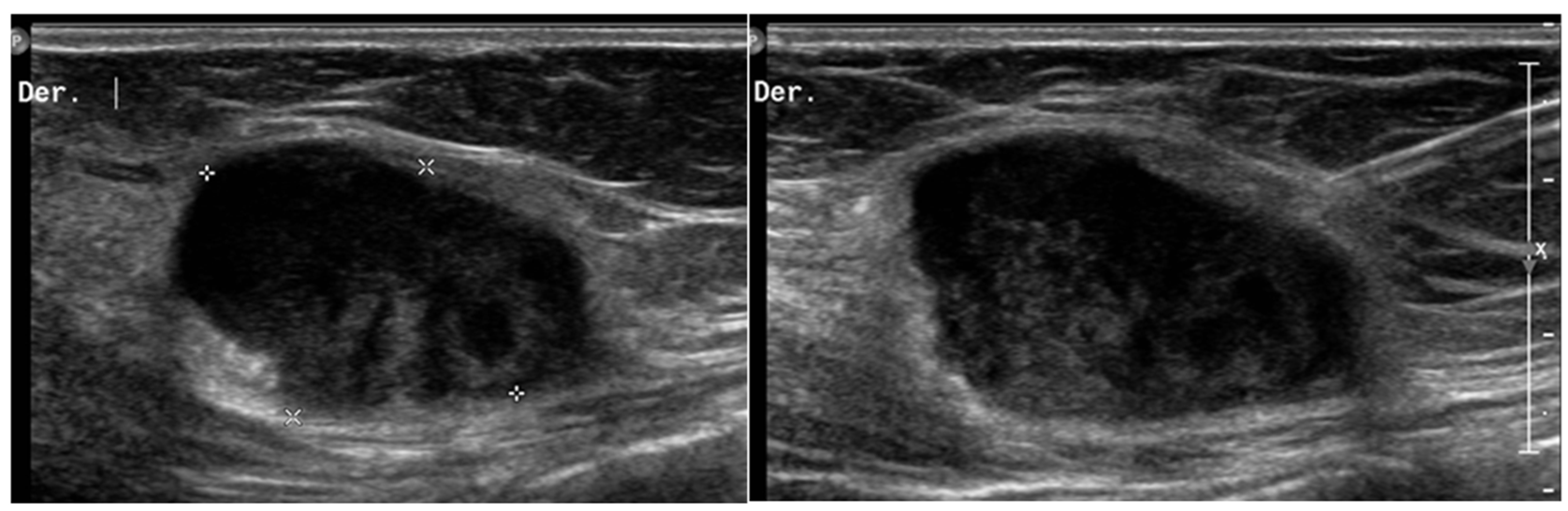 Diagnostics 13 00315 g002