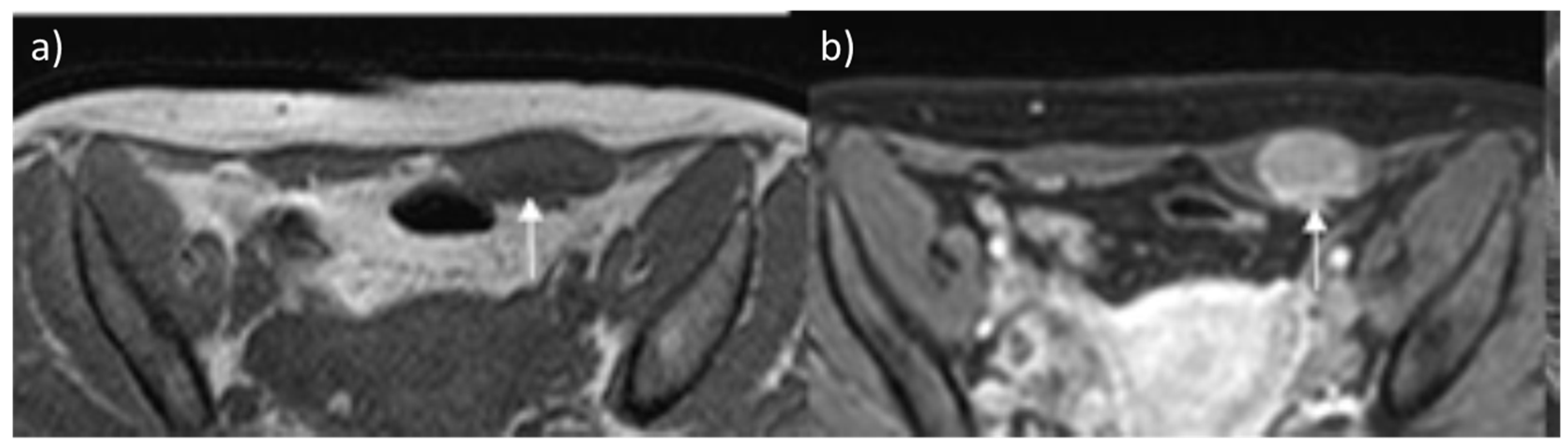 Diagnostics 13 00315 g003
