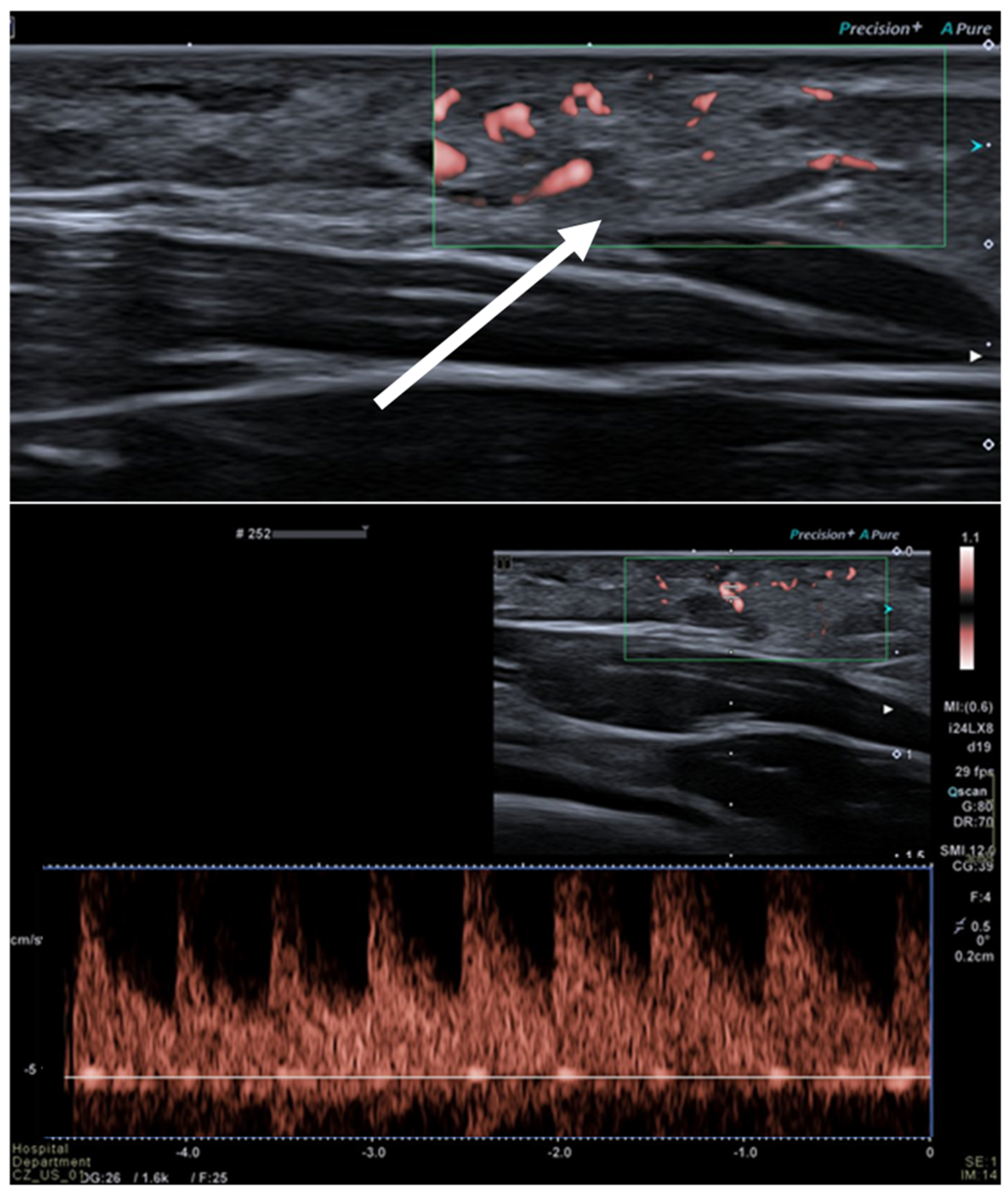 Diagnostics 13 00315 g004