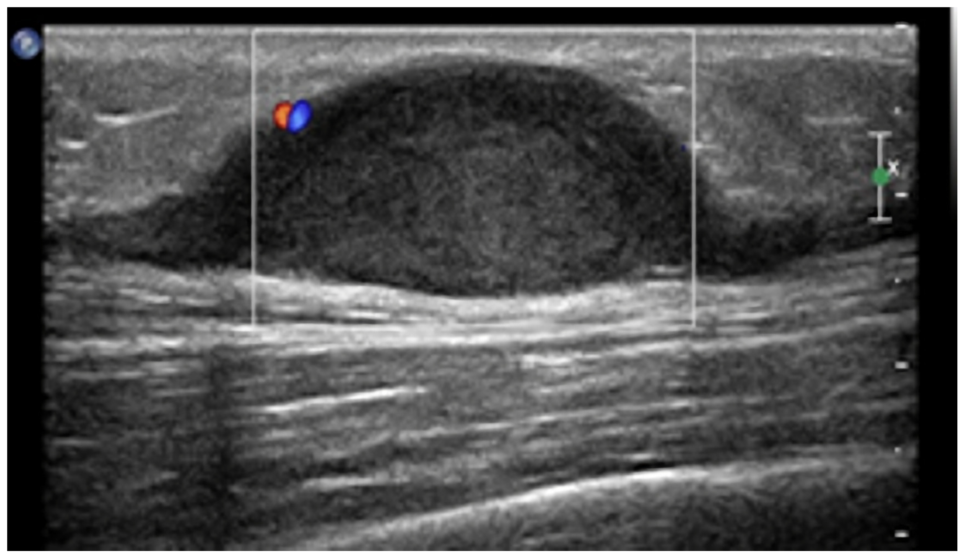 Diagnostics 13 00315 g005