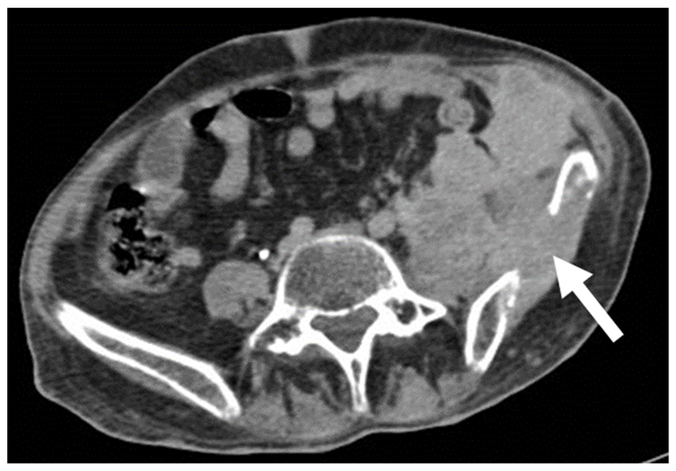 Diagnostics 13 00315 g006