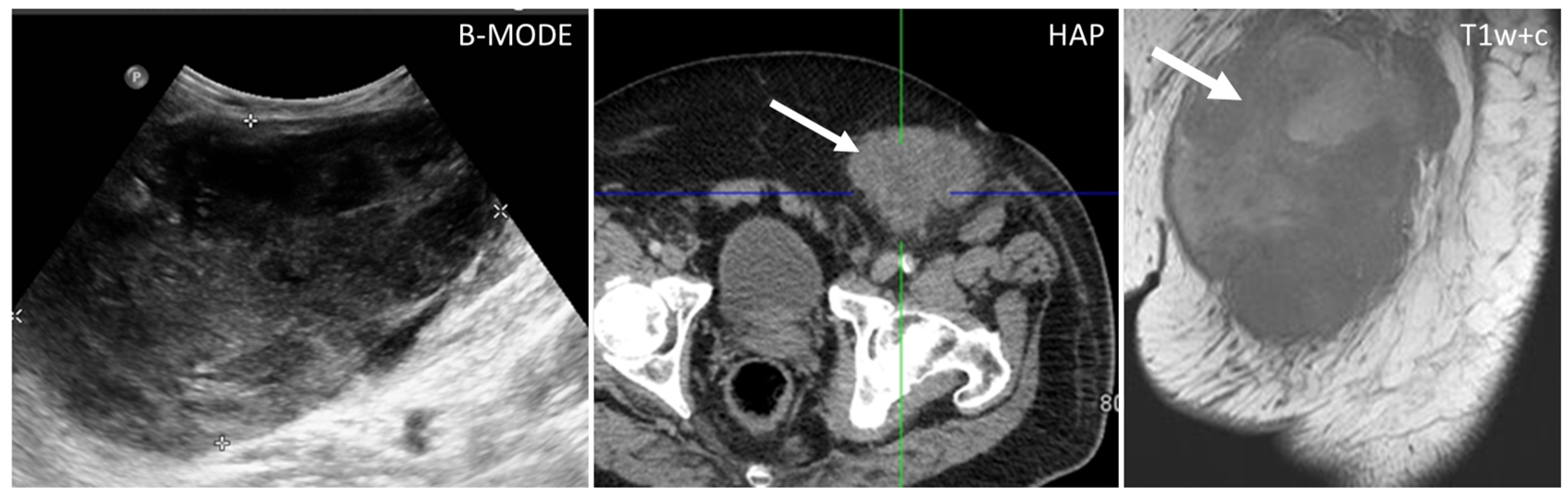 Diagnostics 13 00315 g007