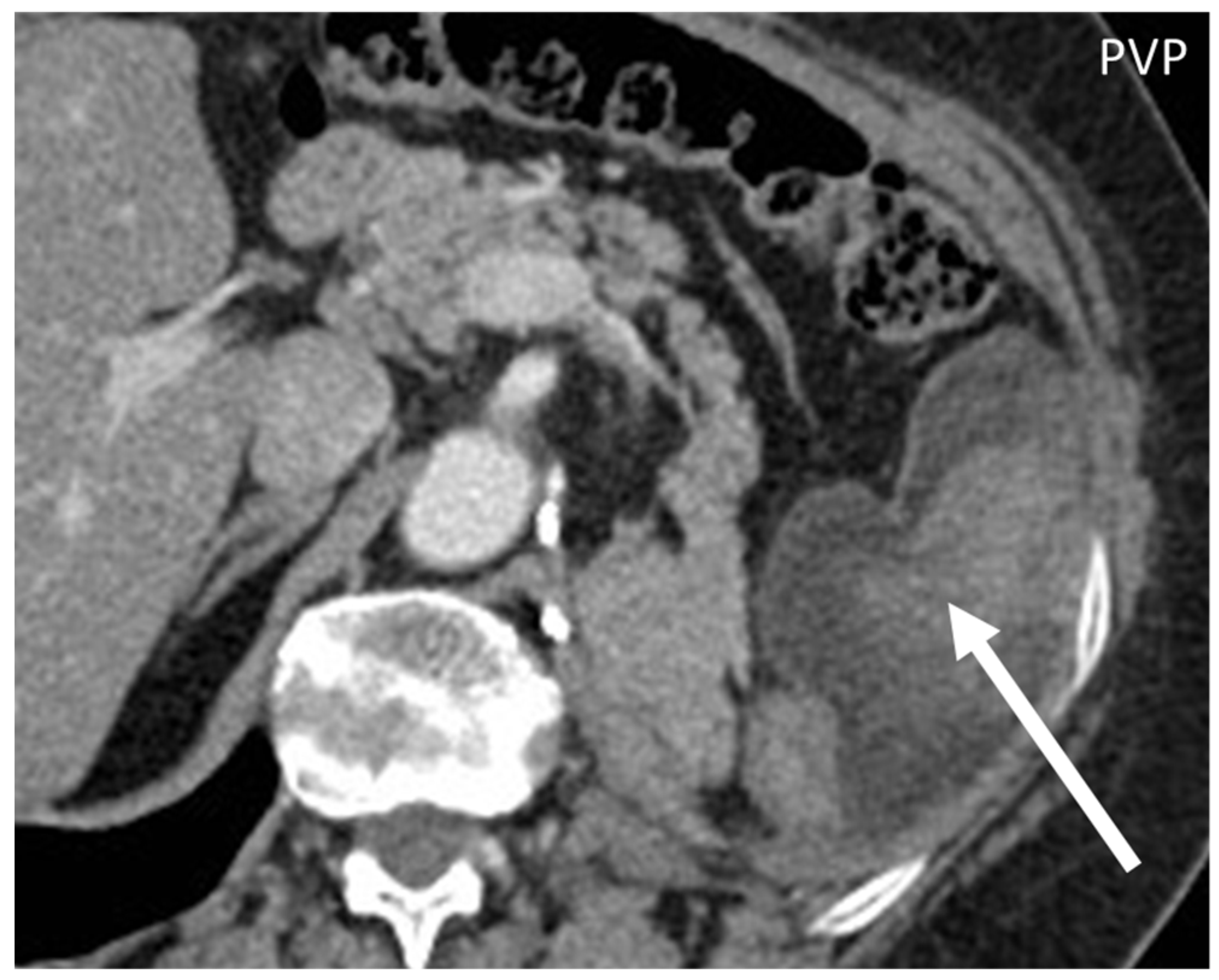 Diagnostics 13 00315 g008
