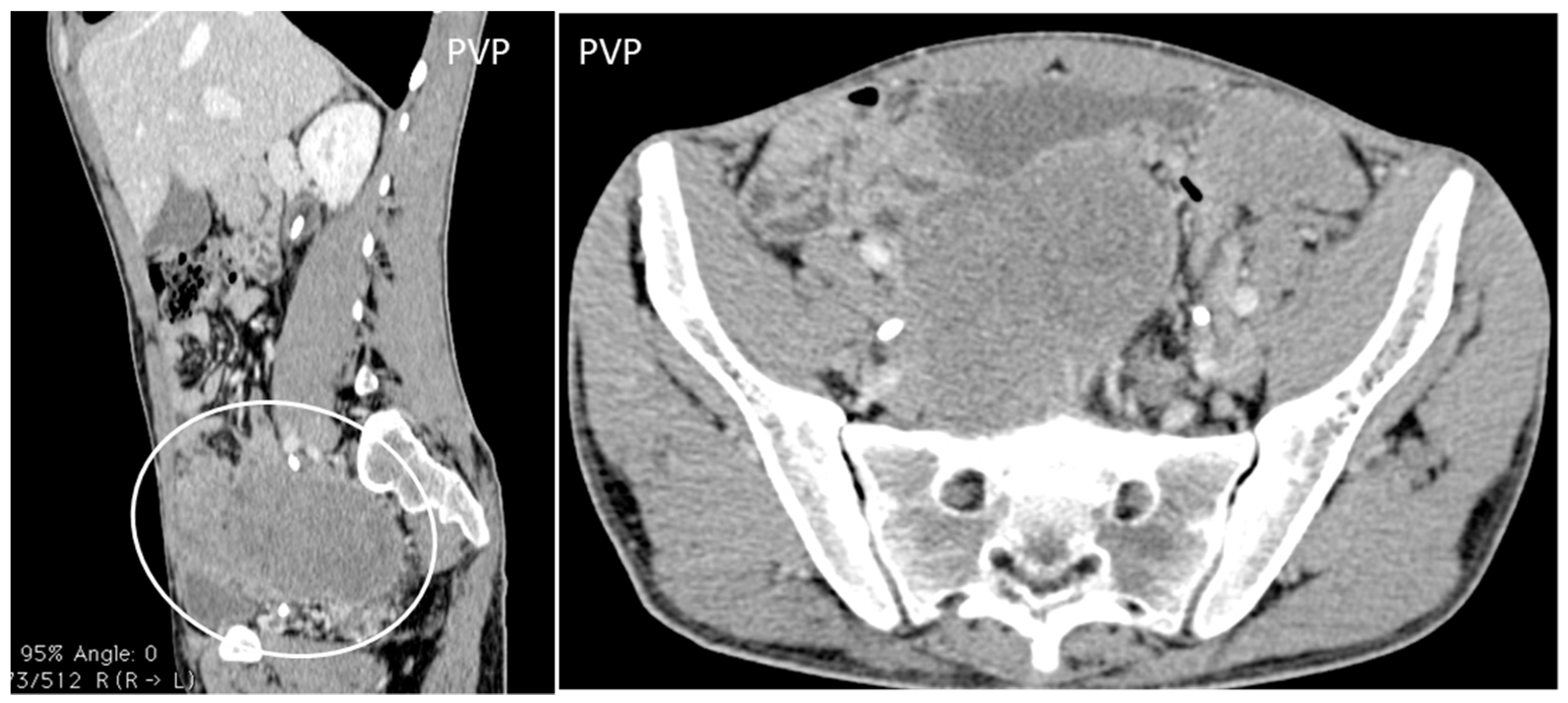 Diagnostics 13 00315 g010