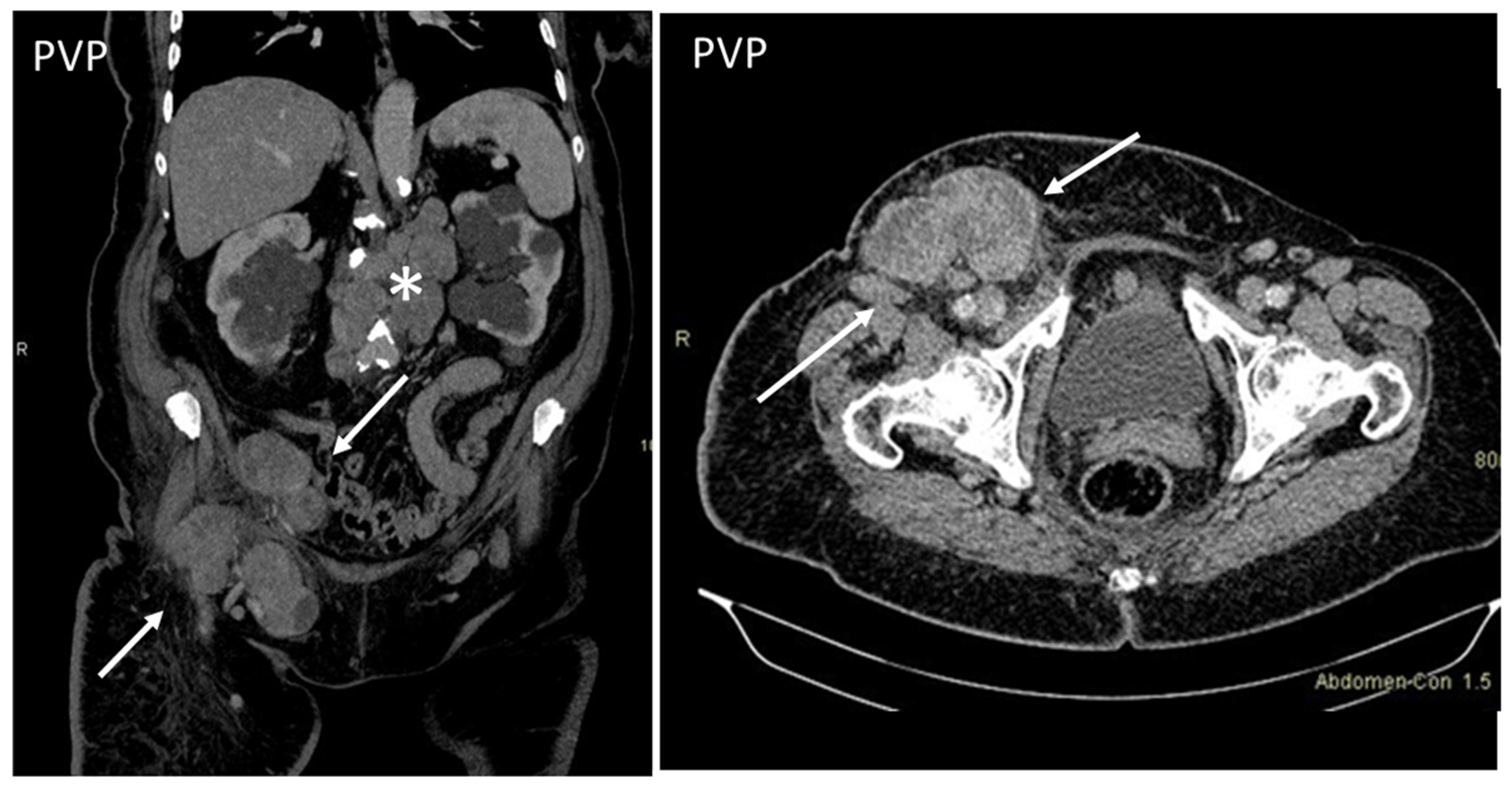 Diagnostics 13 00315 g011
