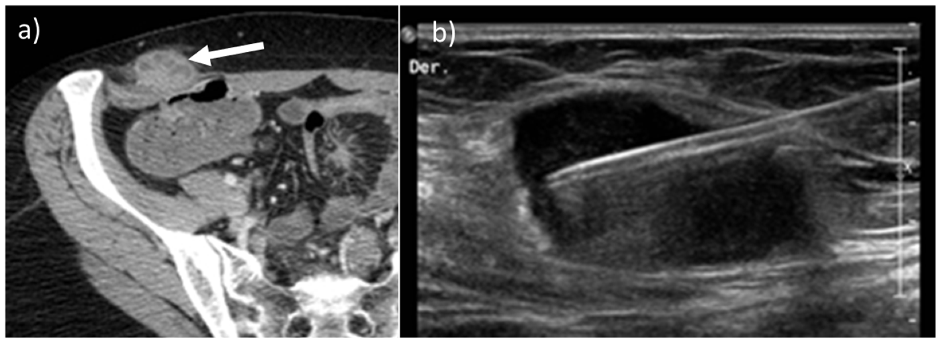 Diagnostics 13 00315 g012
