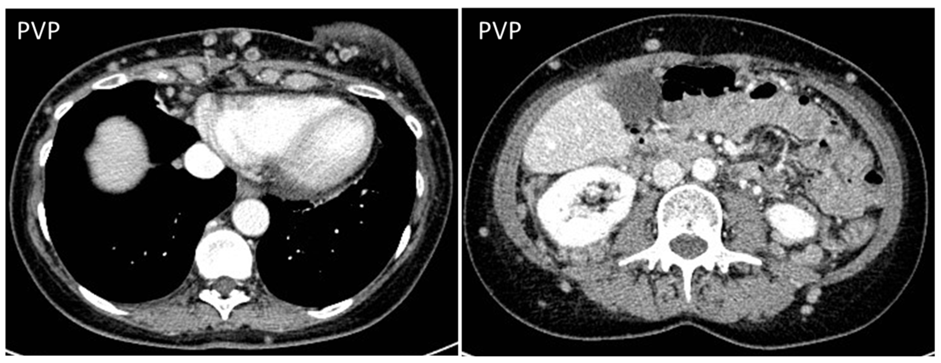 Diagnostics 13 00315 g013