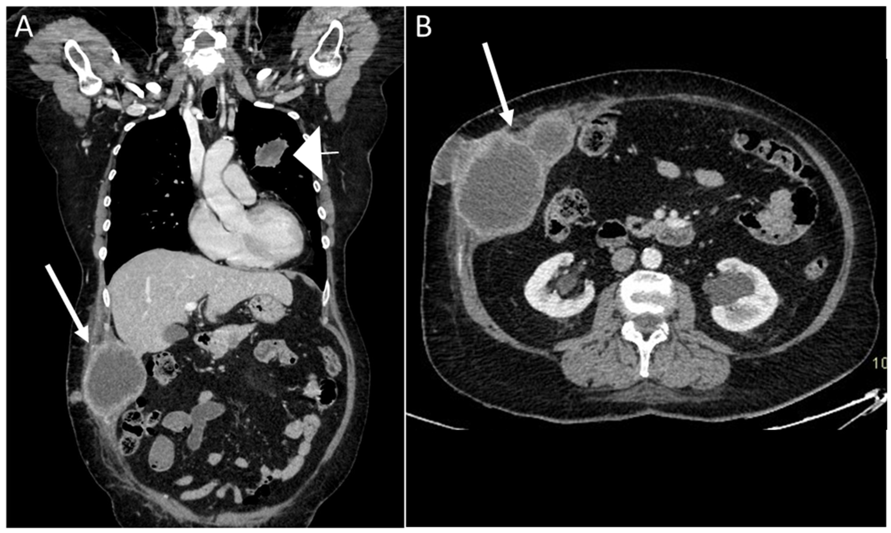 Diagnostics 13 00315 g014