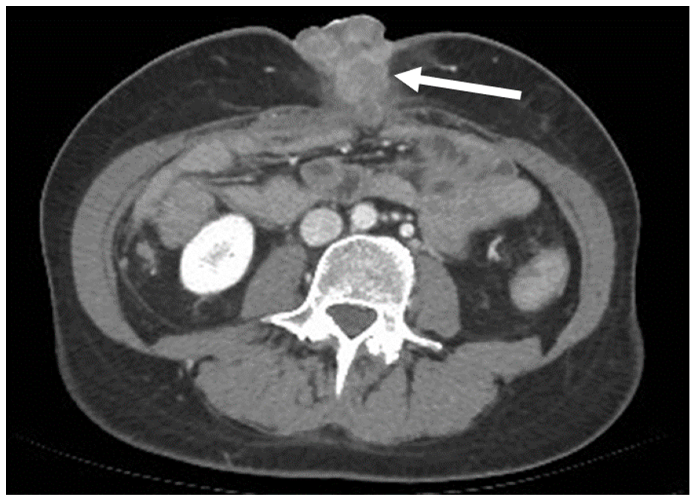Diagnostics 13 00315 g015