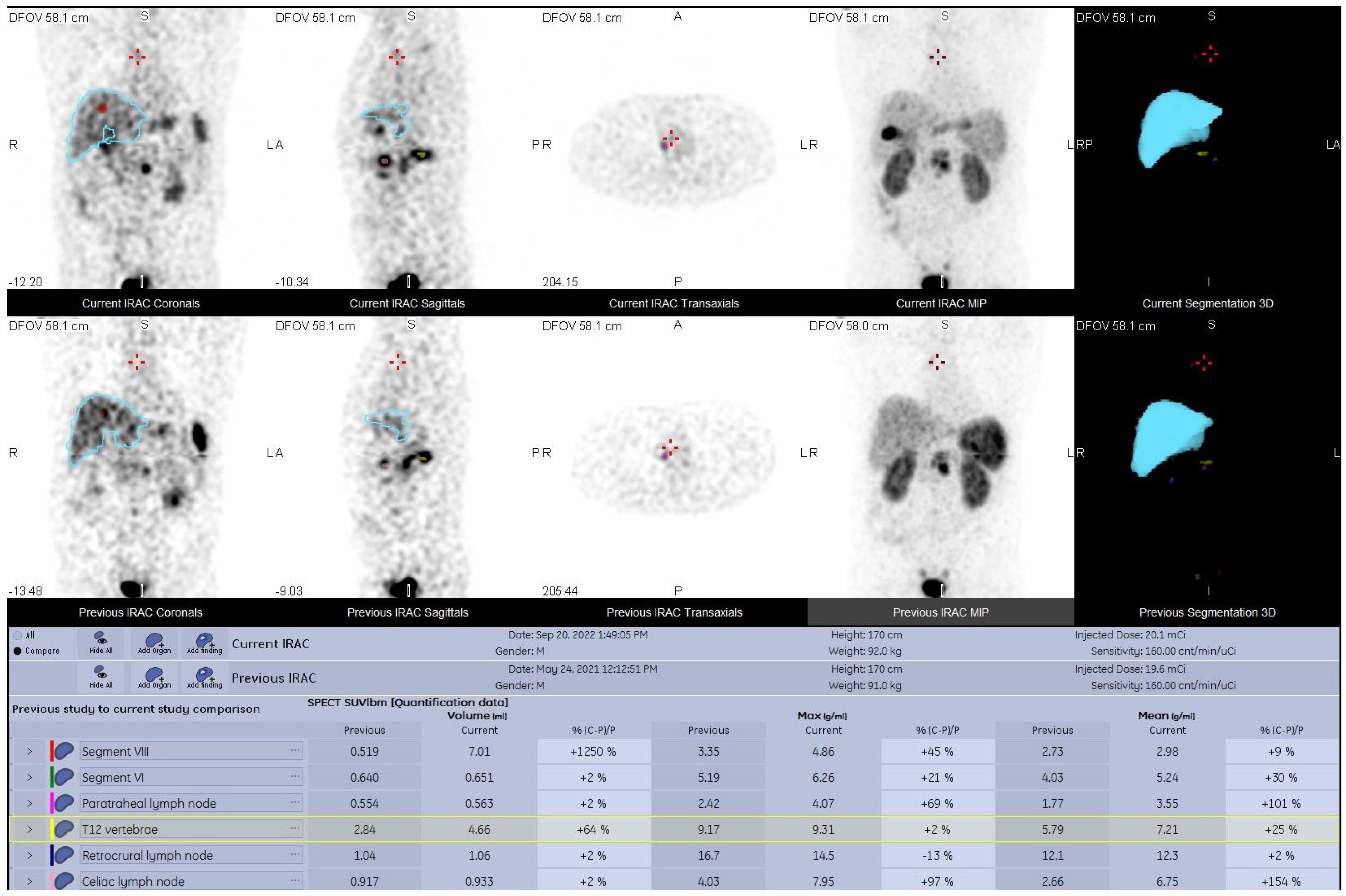 Diagnostics 13 00318 g003