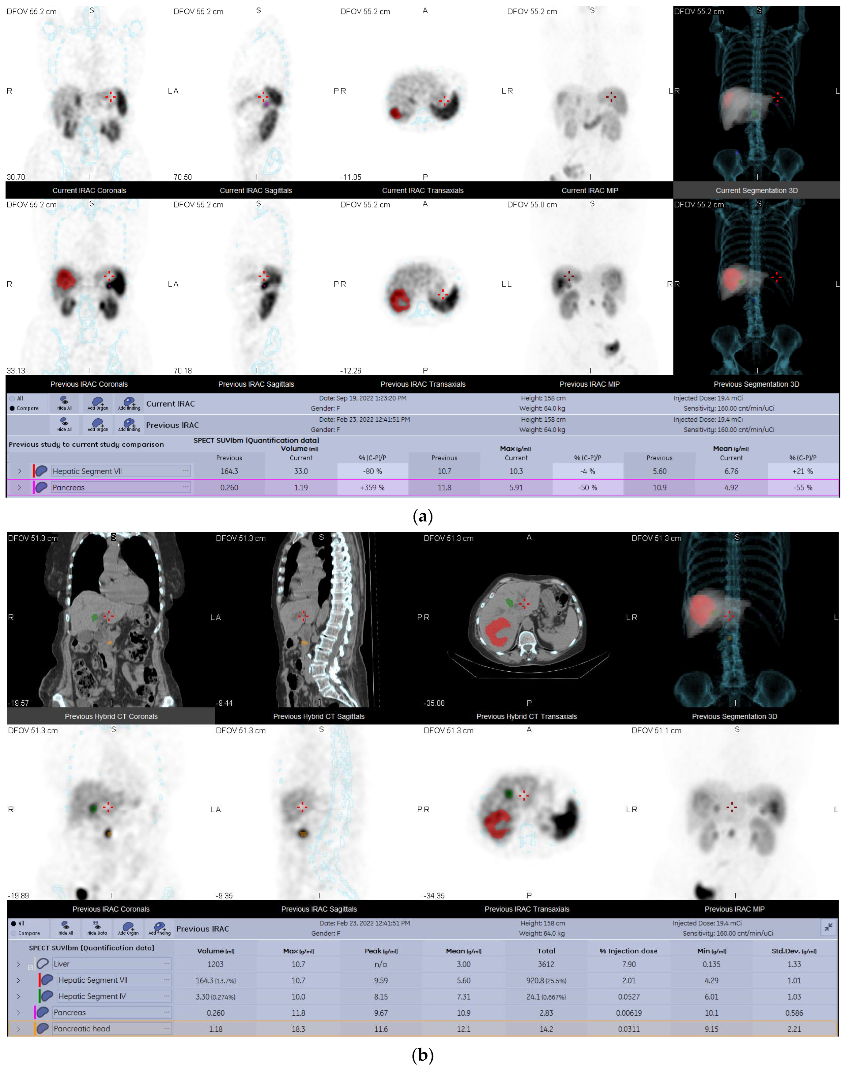 Diagnostics 13 00318 g004a