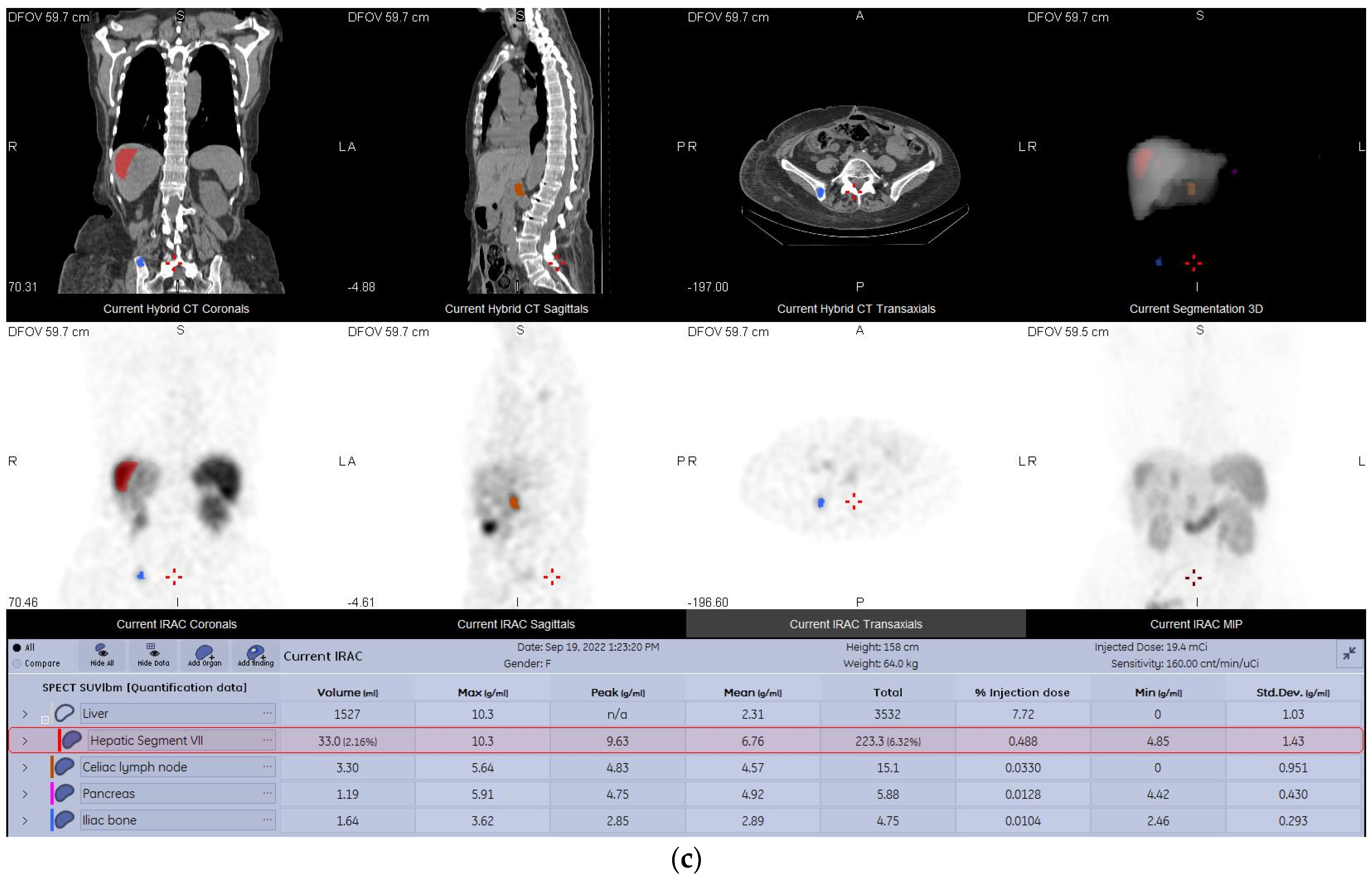 Diagnostics 13 00318 g004b