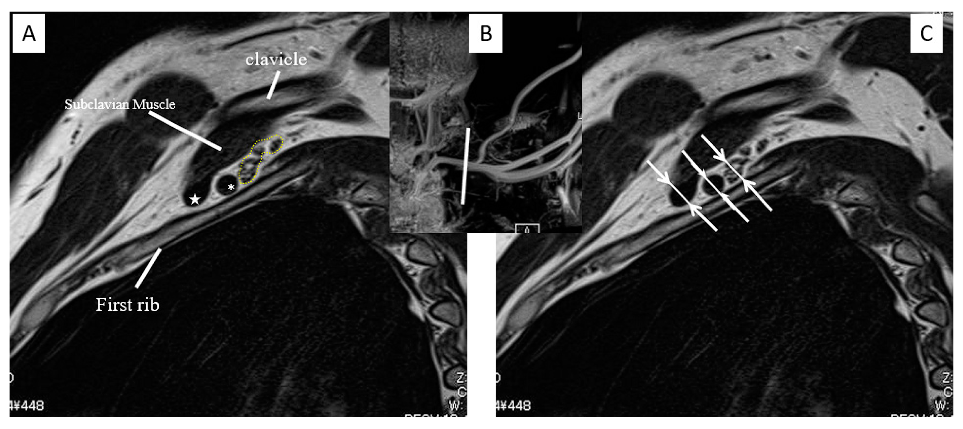 Diagnostics 13 00319 g004