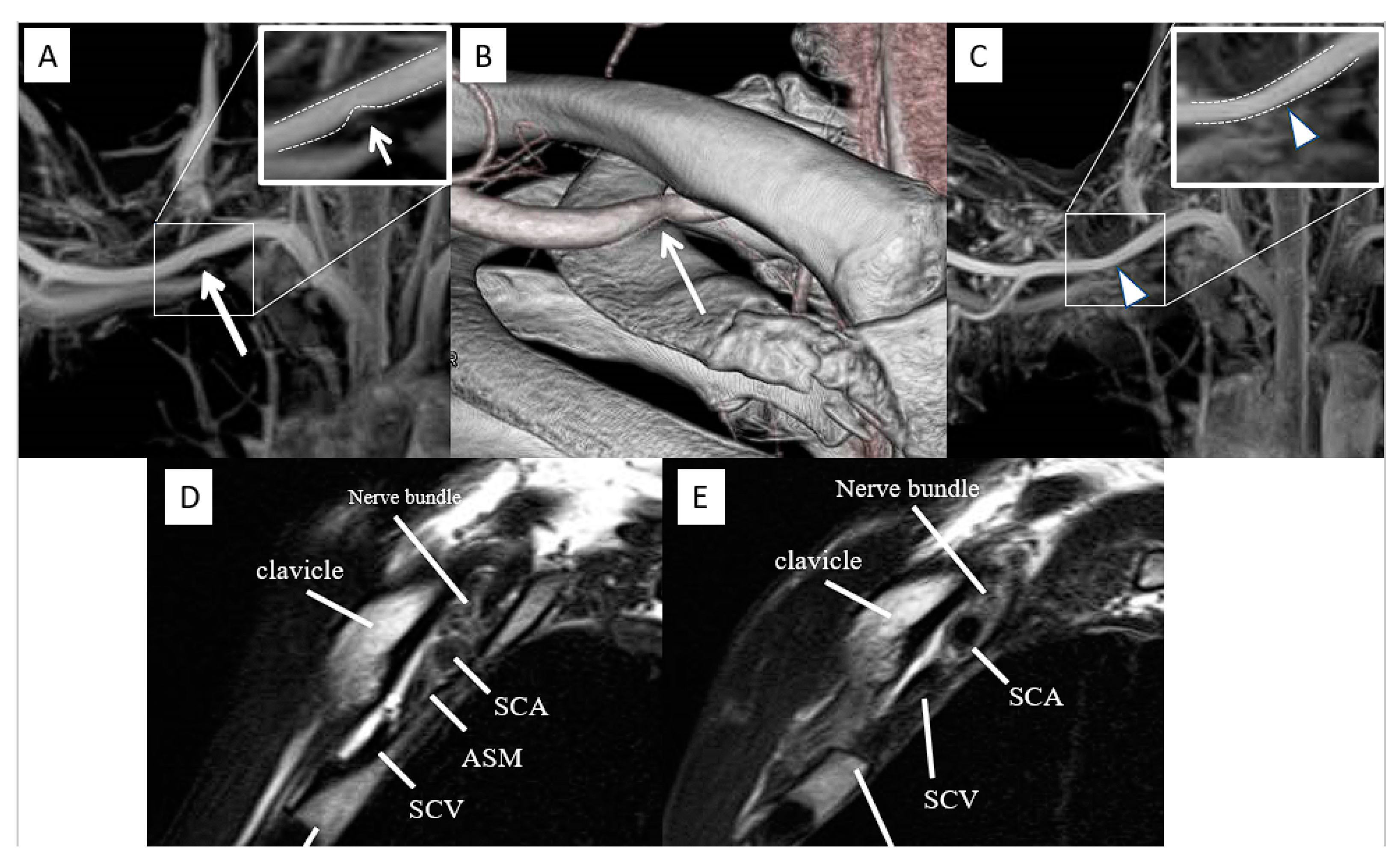 Diagnostics 13 00319 g006