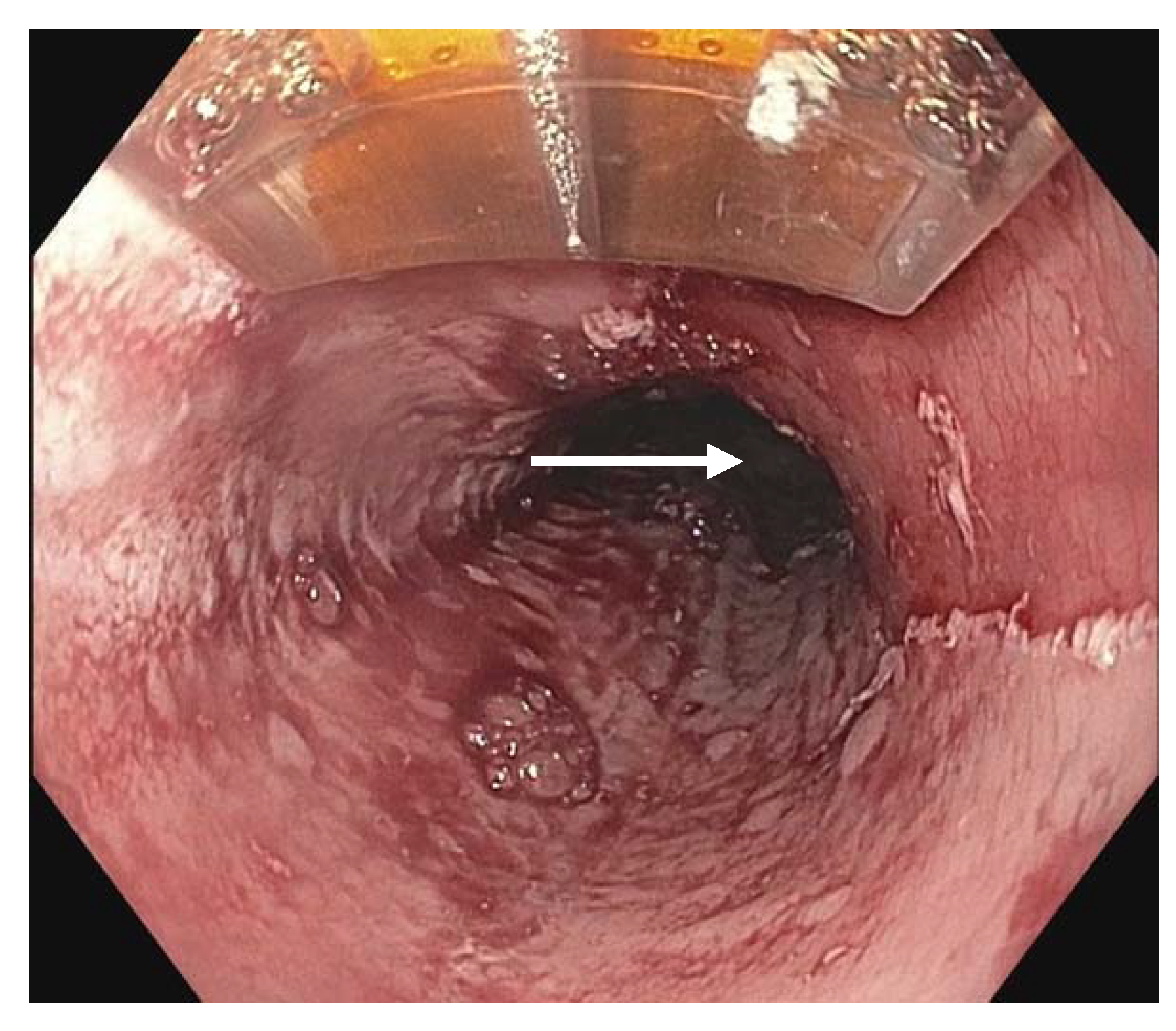 Diagnostics 13 00321 g003