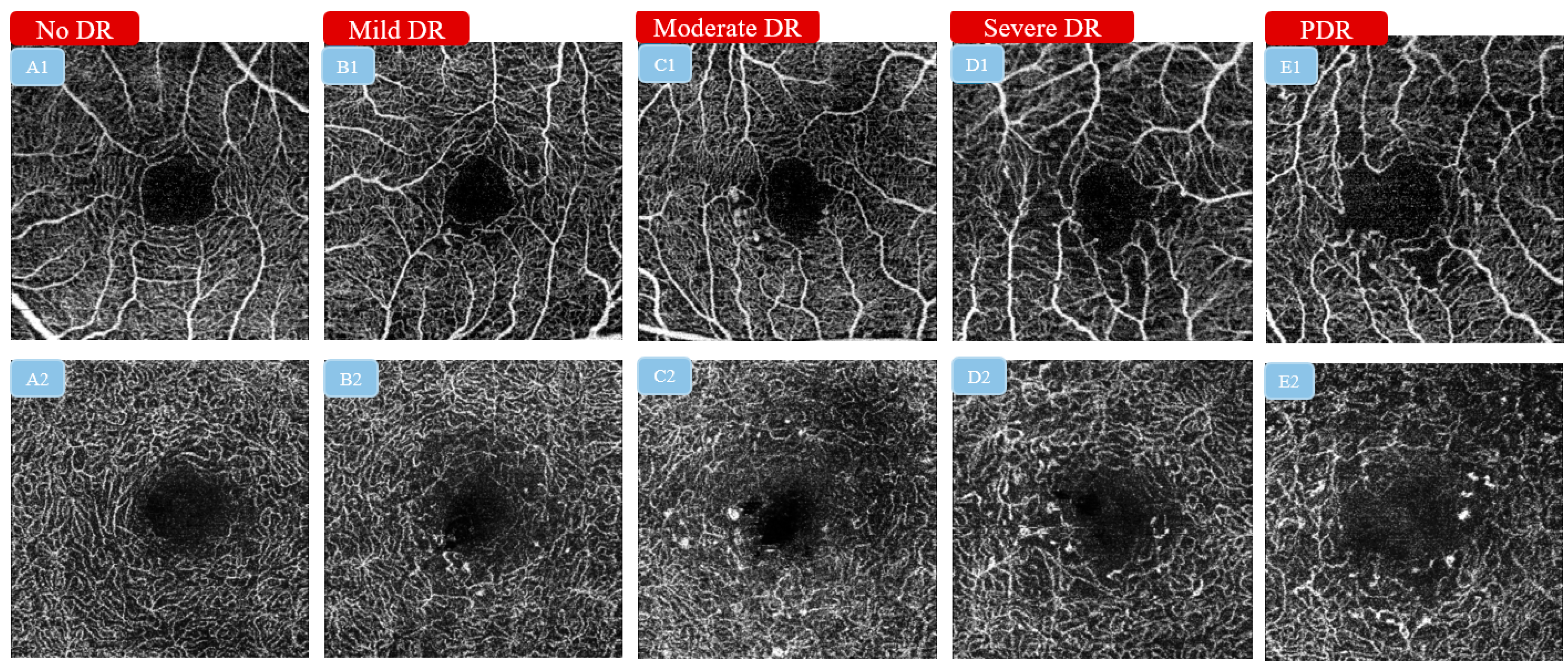 Diagnostics 13 00326 g001
