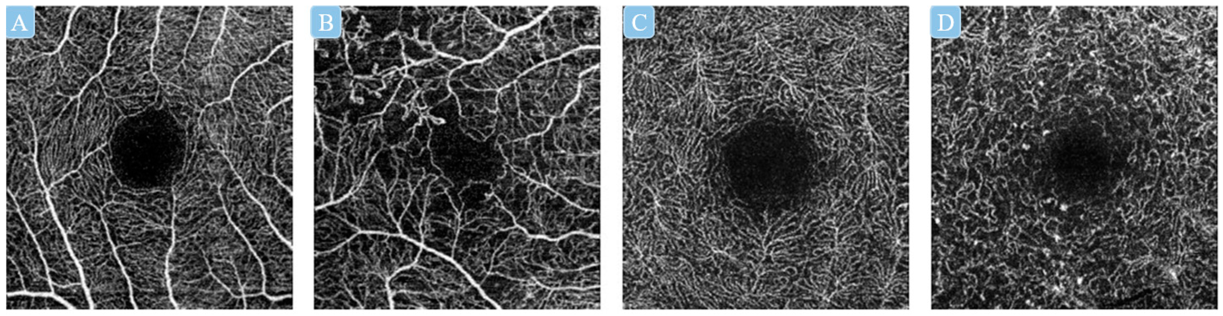 Diagnostics 13 00326 g004