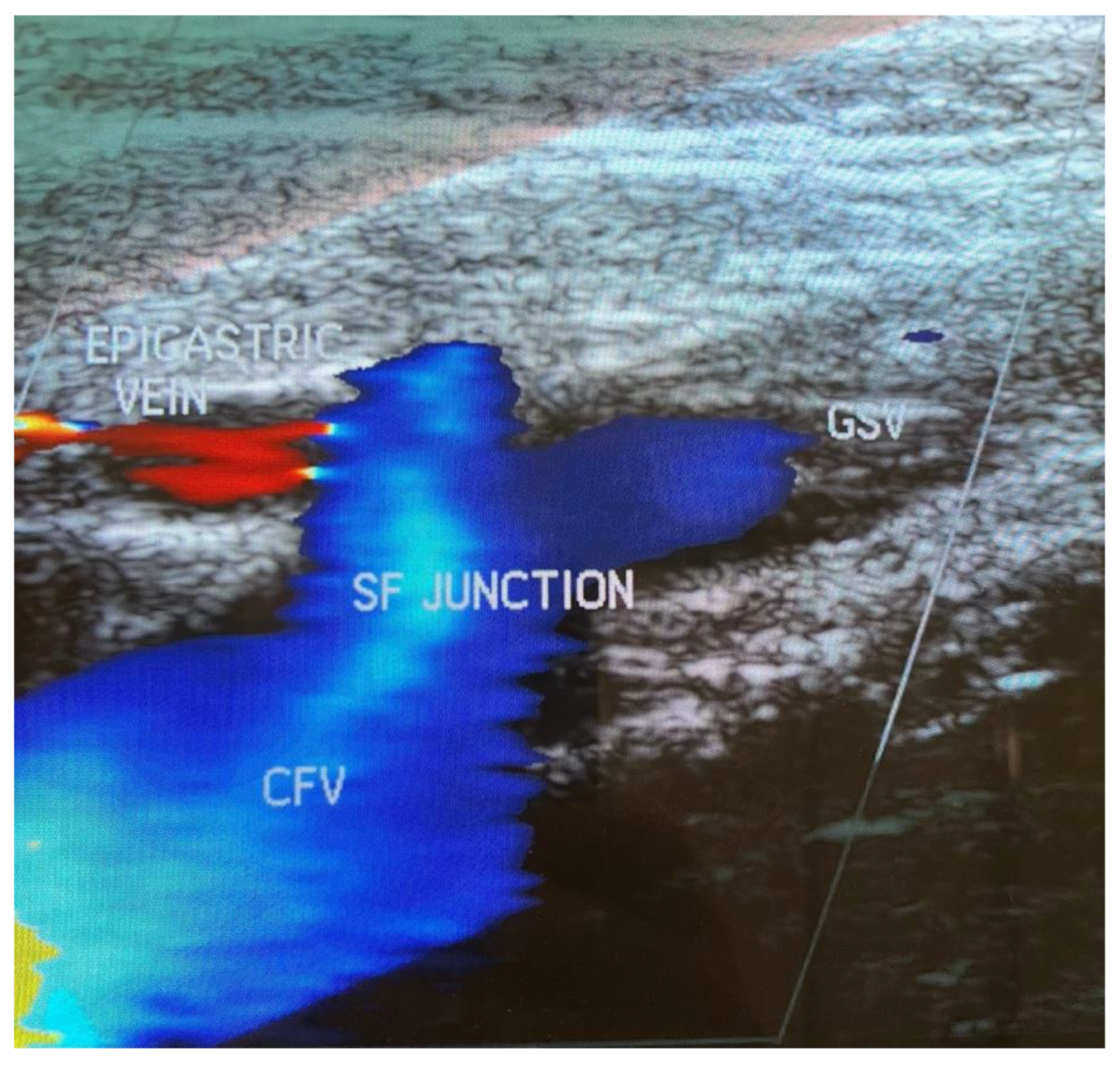 Diagnostics 13 00327 g004