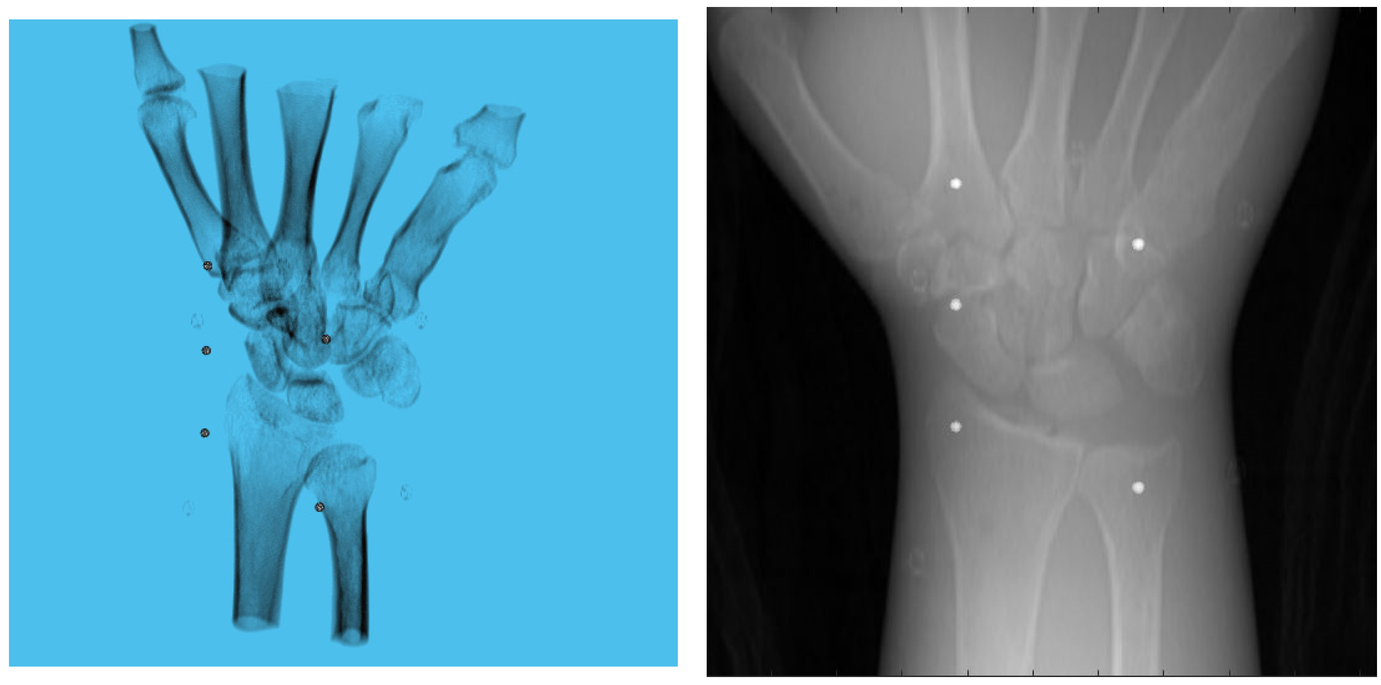 Diagnostics 13 00330 g006