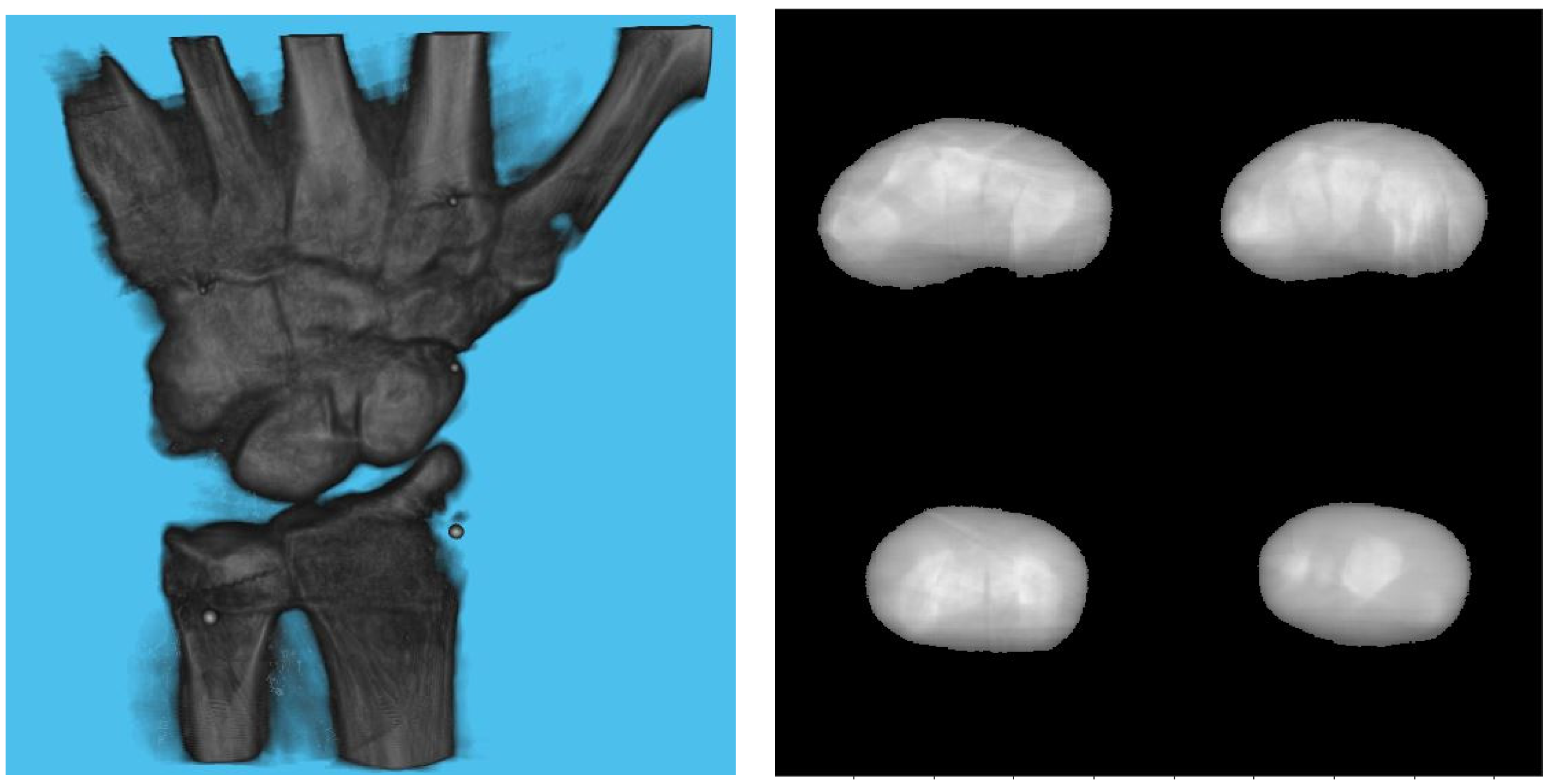Diagnostics 13 00330 g011