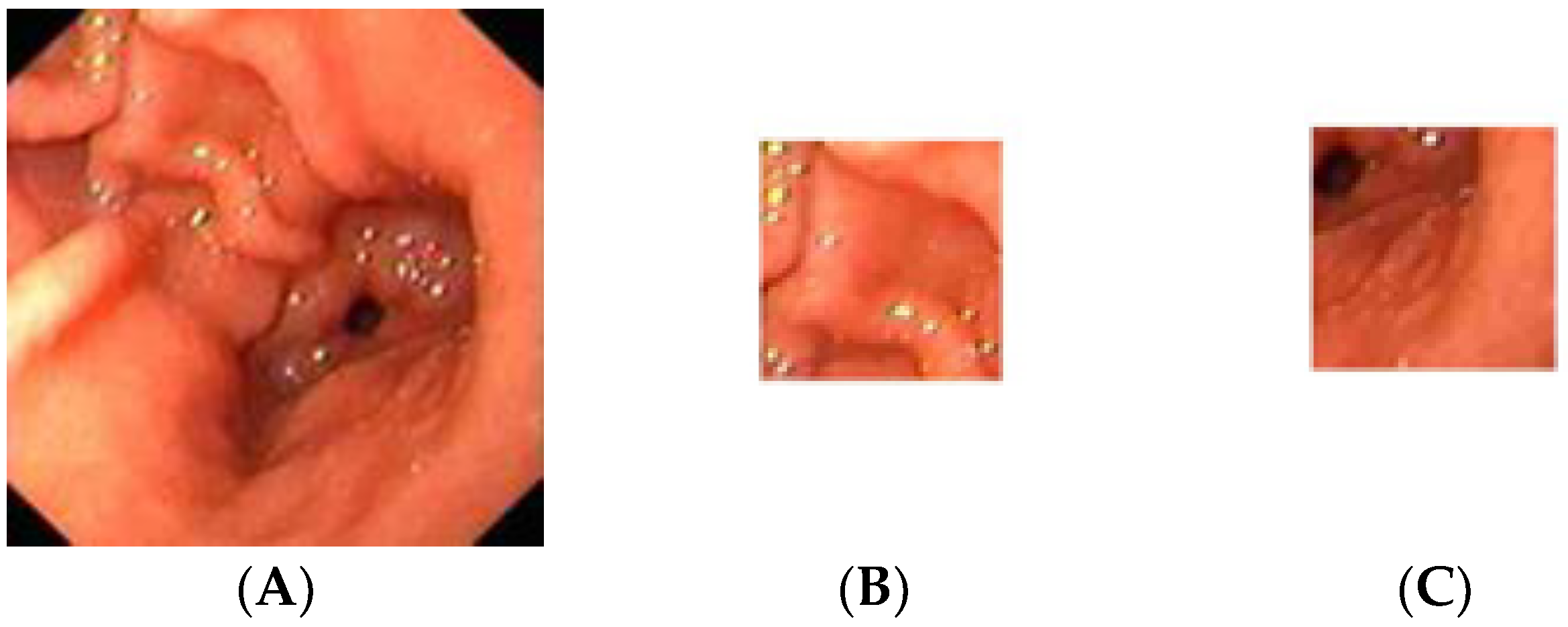 Diagnostics 13 00336 g002