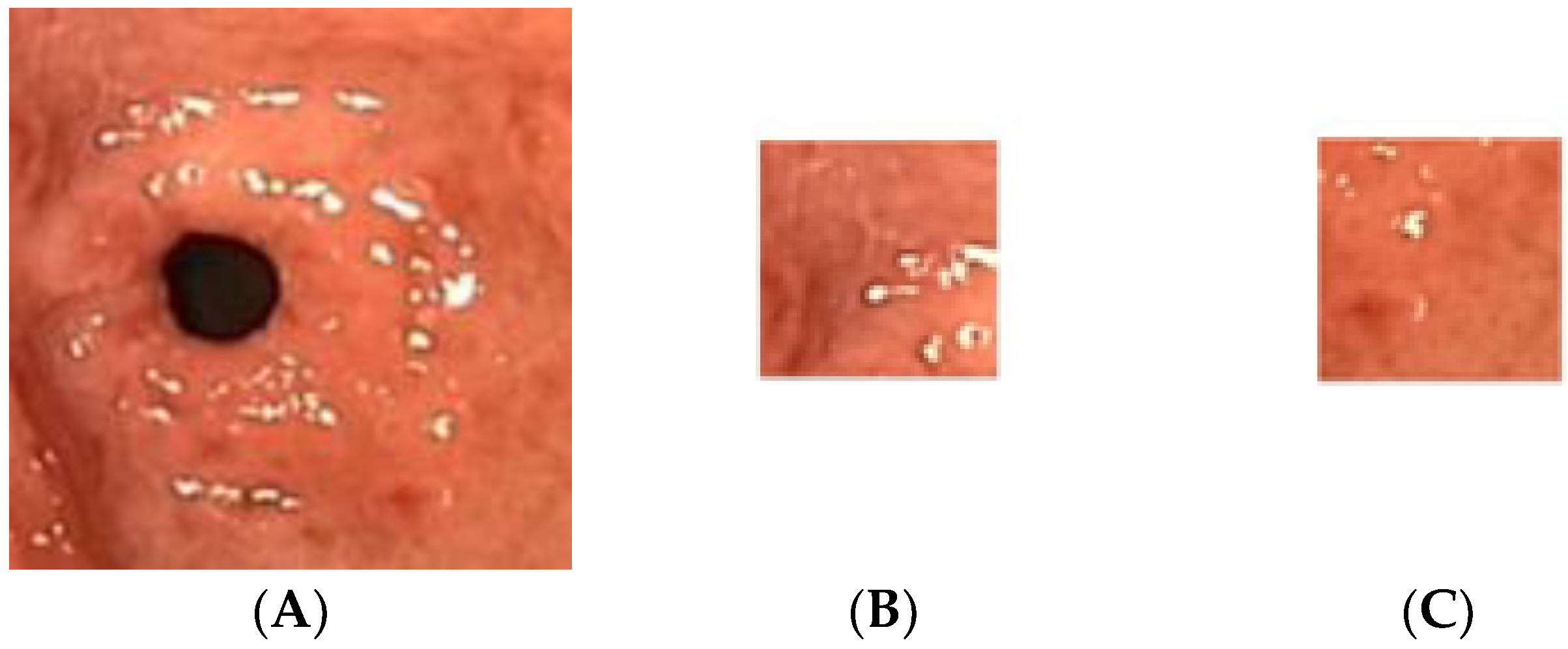 Diagnostics 13 00336 g003
