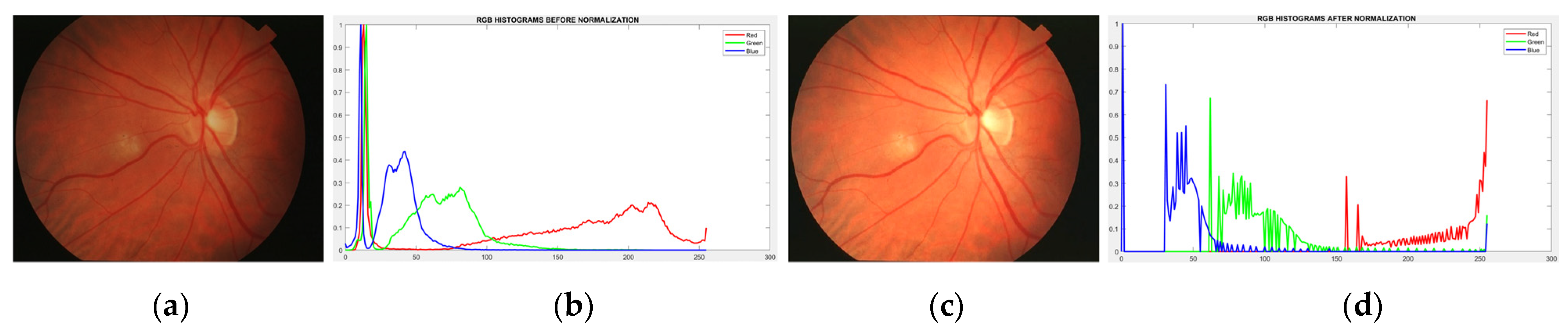 Diagnostics 13 00342 g003 Diagnostics 13 00342 g003