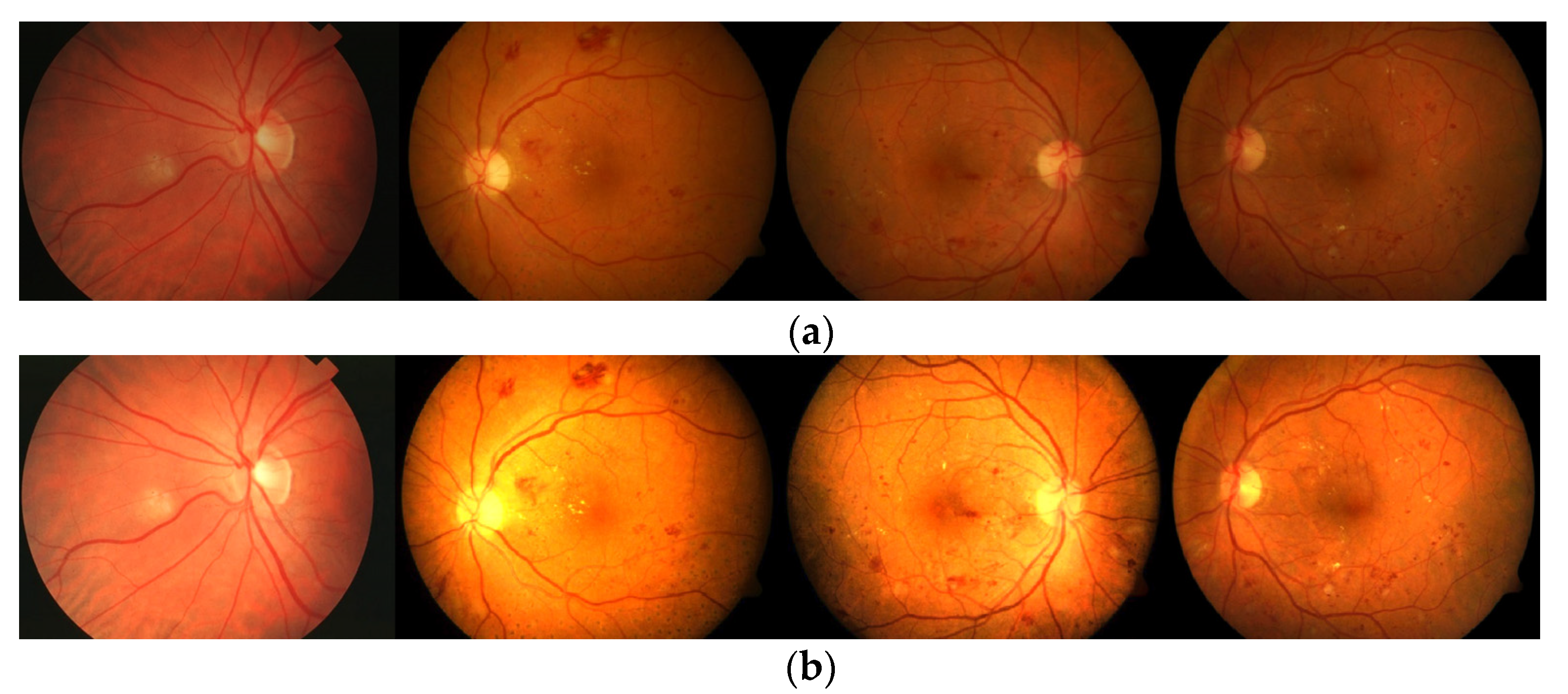 Diagnostics 13 00342 g004 Diagnostics 13 00342 g004