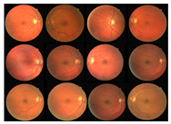 Diagnostics 13 00342 i001 Diagnostics 13 00342 i001