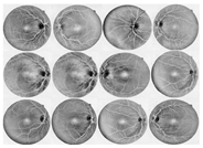 Diagnostics 13 00342 i002 Diagnostics 13 00342 i002